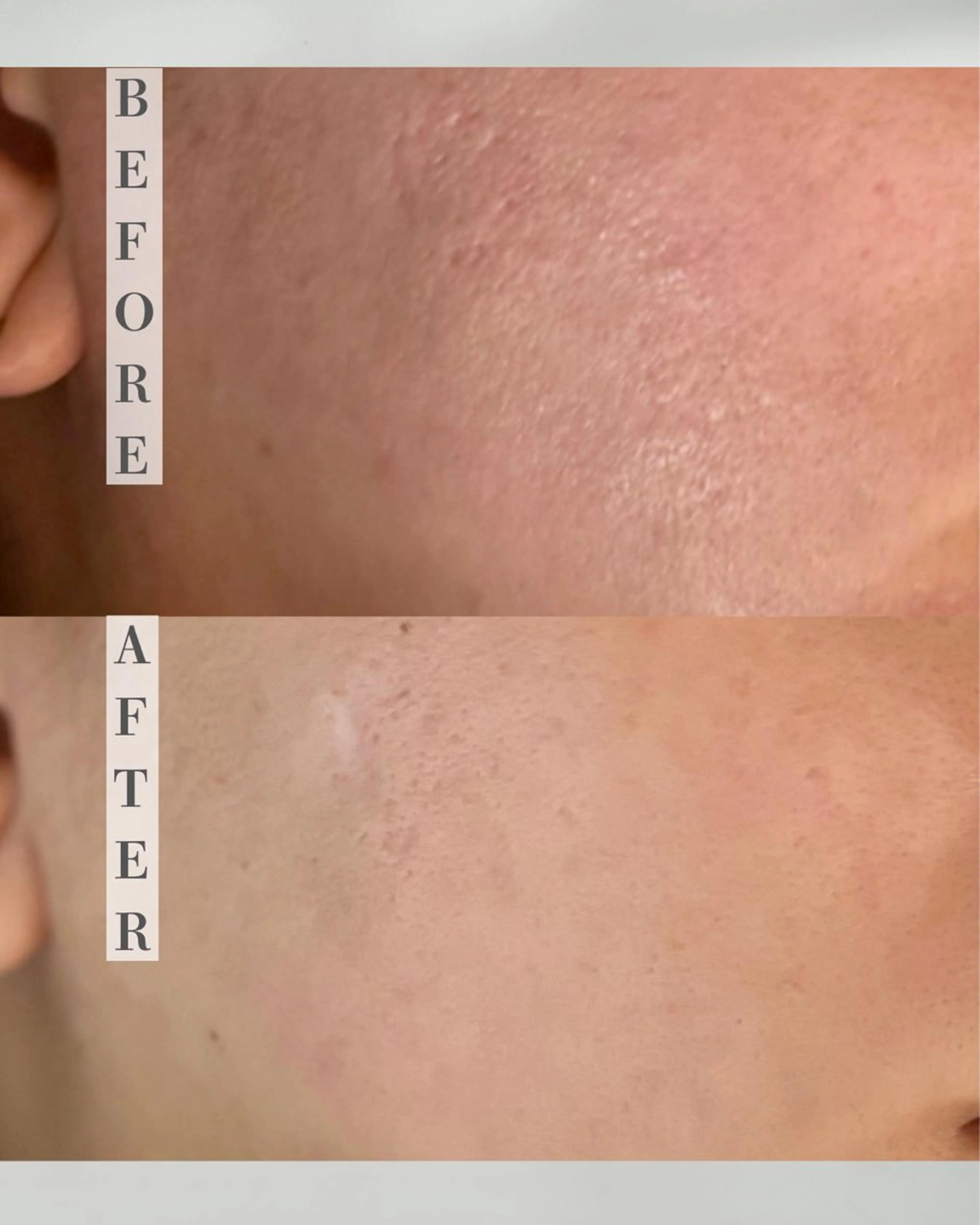 カムイ所属・カムイ 山﨑のエステ・リラクイメージ