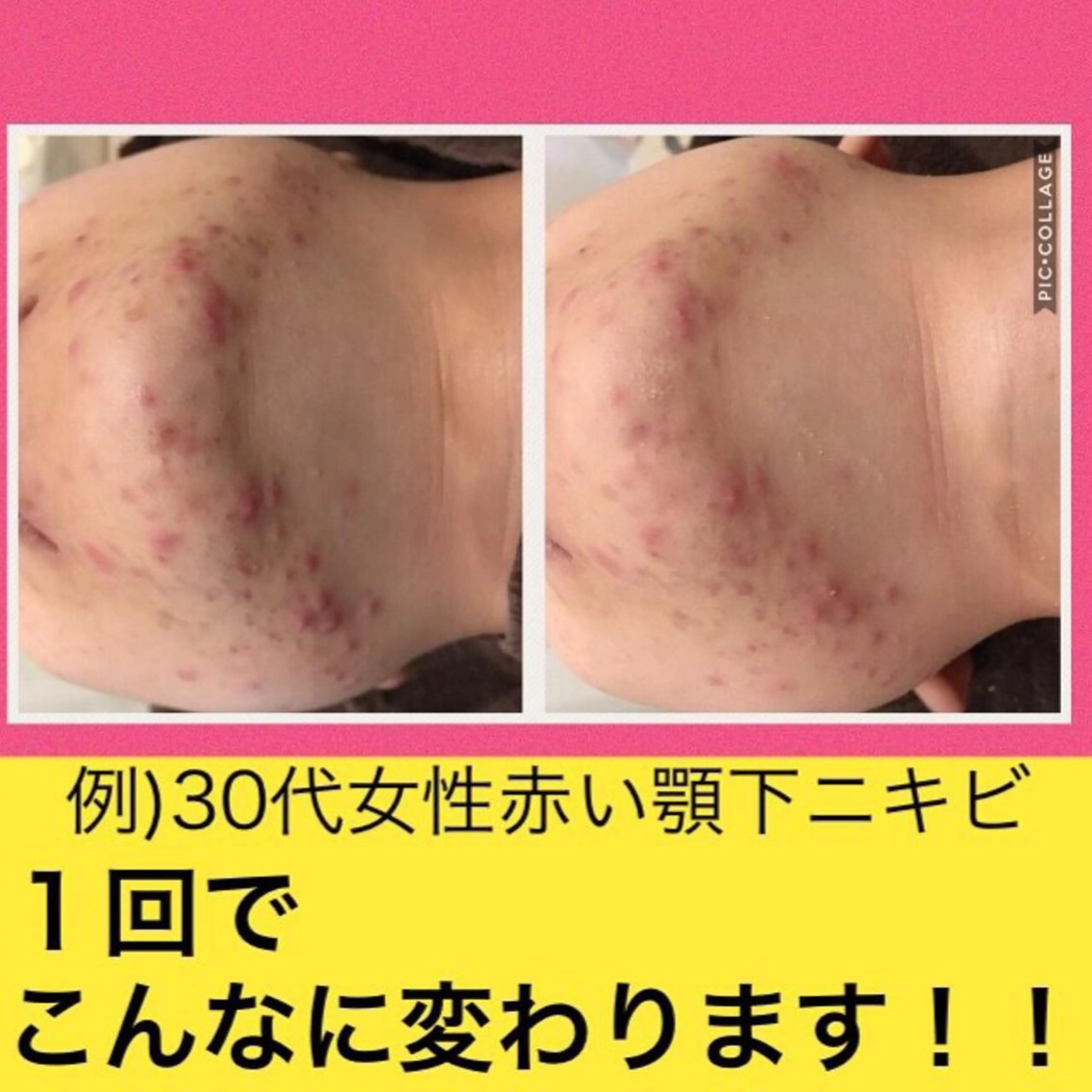 ミディアム カラー パーマ ヘアアレンジ メンズ キッズ ネイル マツエク・マツパ ニキビ・肌質改善専門 ♡人生が変わるサロンのエステ・リラクイメージ