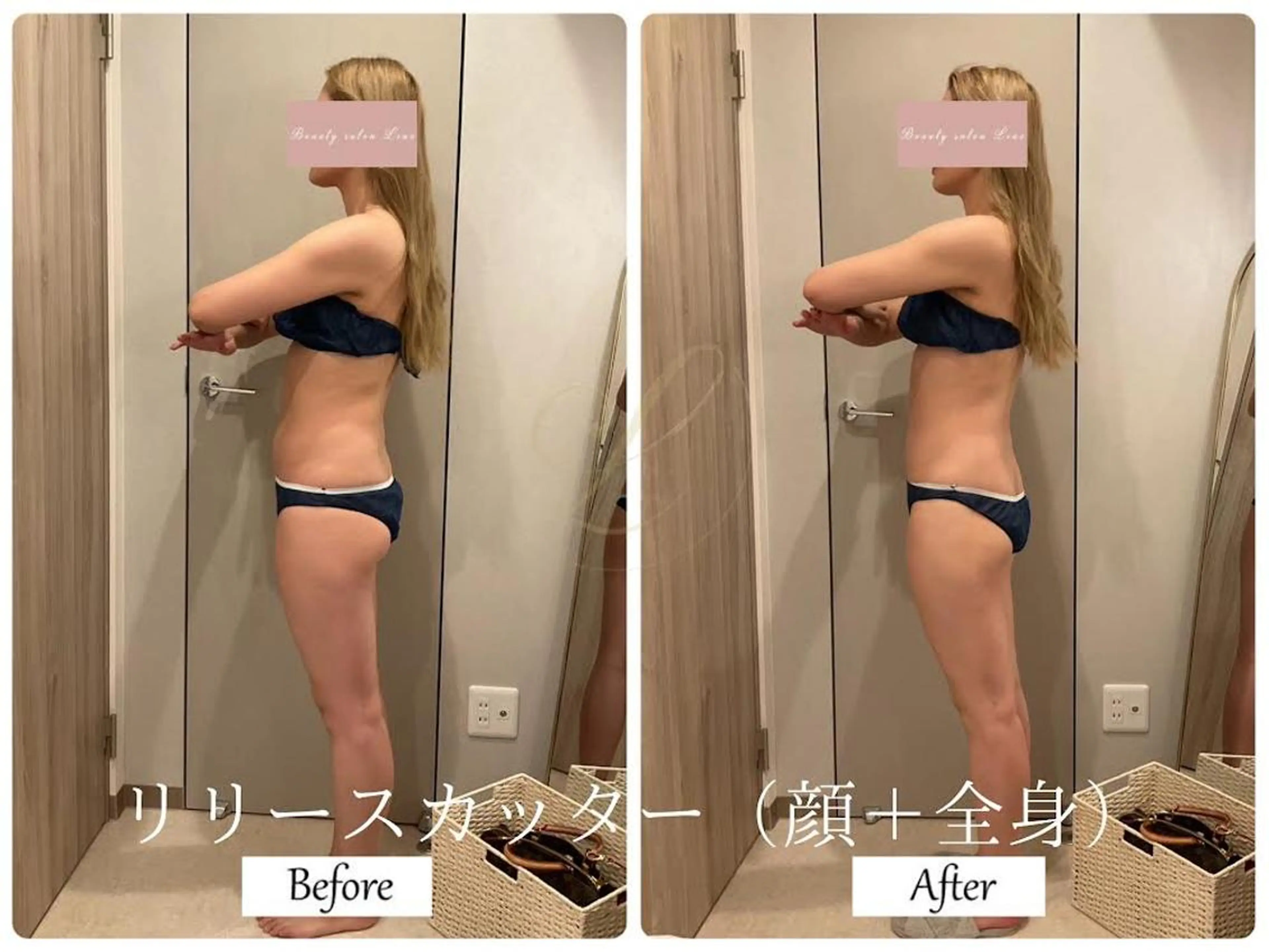 エステ リラク ブライダルサロン ｜Lino【堀江】のエステ・リラクイメージ