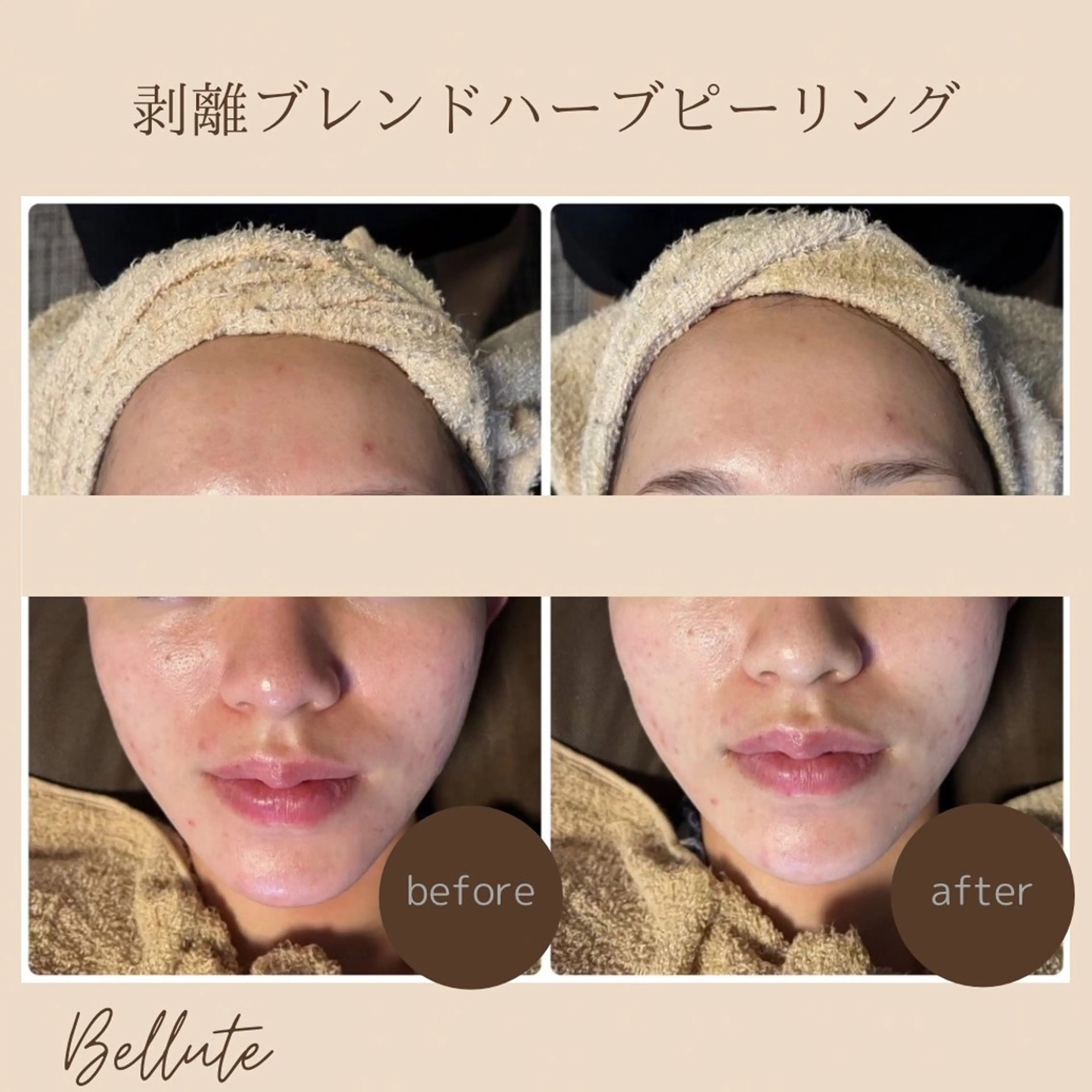 エステ リラク ピーリング専門店 Belluteのエステ・リラクイメージ
