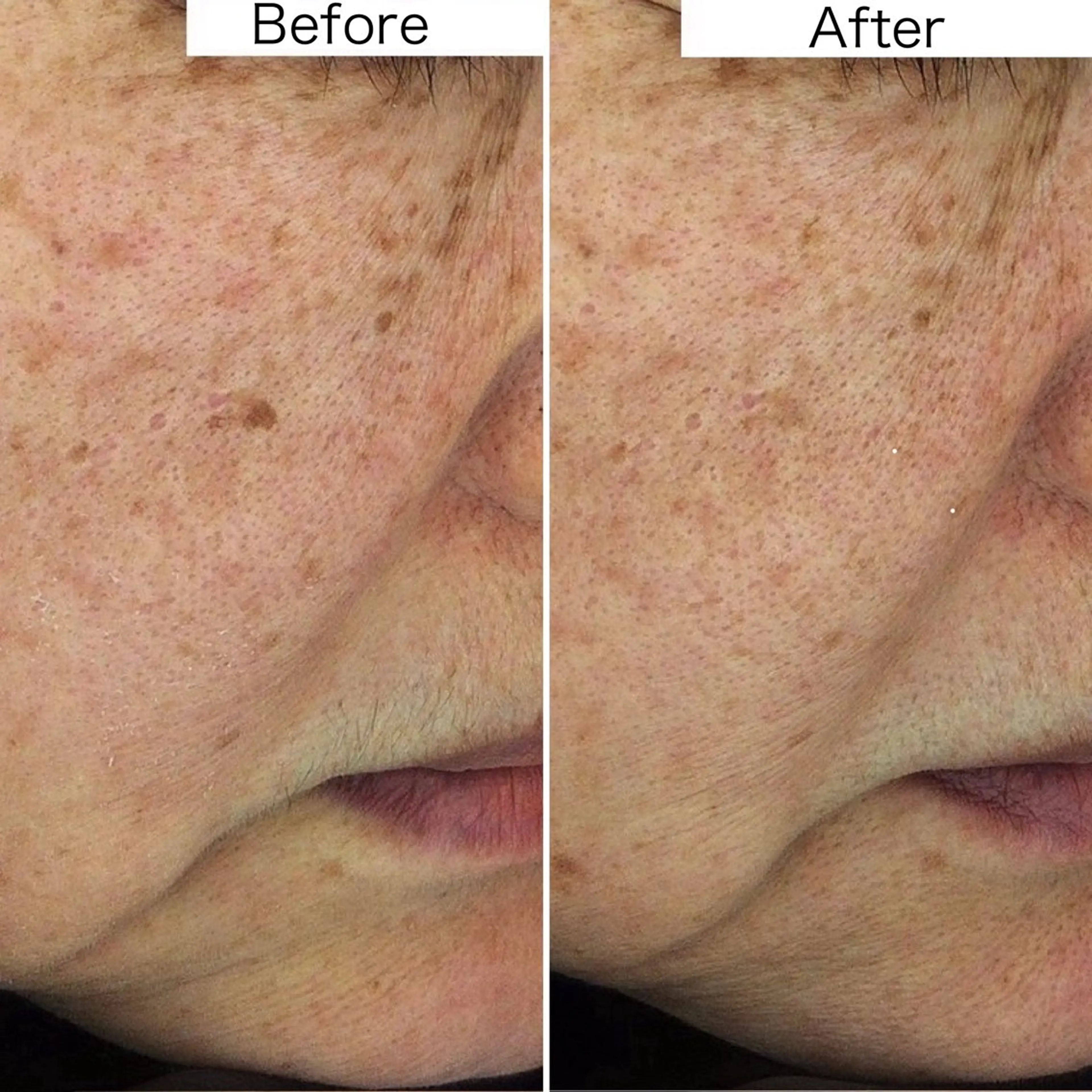 医師推奨サロン ディーキャットリーのエステ・リラクイメージ