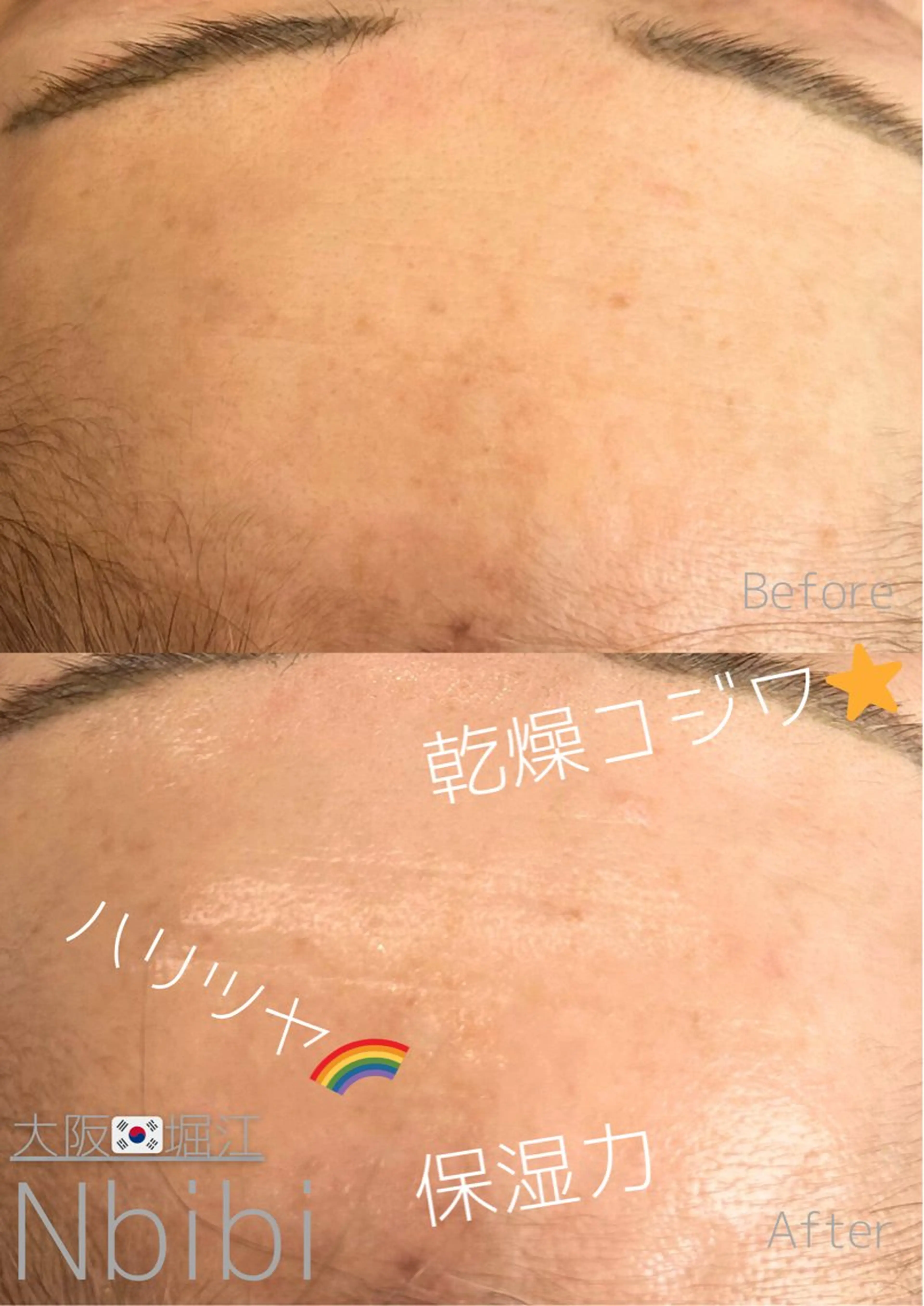 エステ 韓国🇰🇷価格 サロン_Nbibiのエステ・リラクイメージ