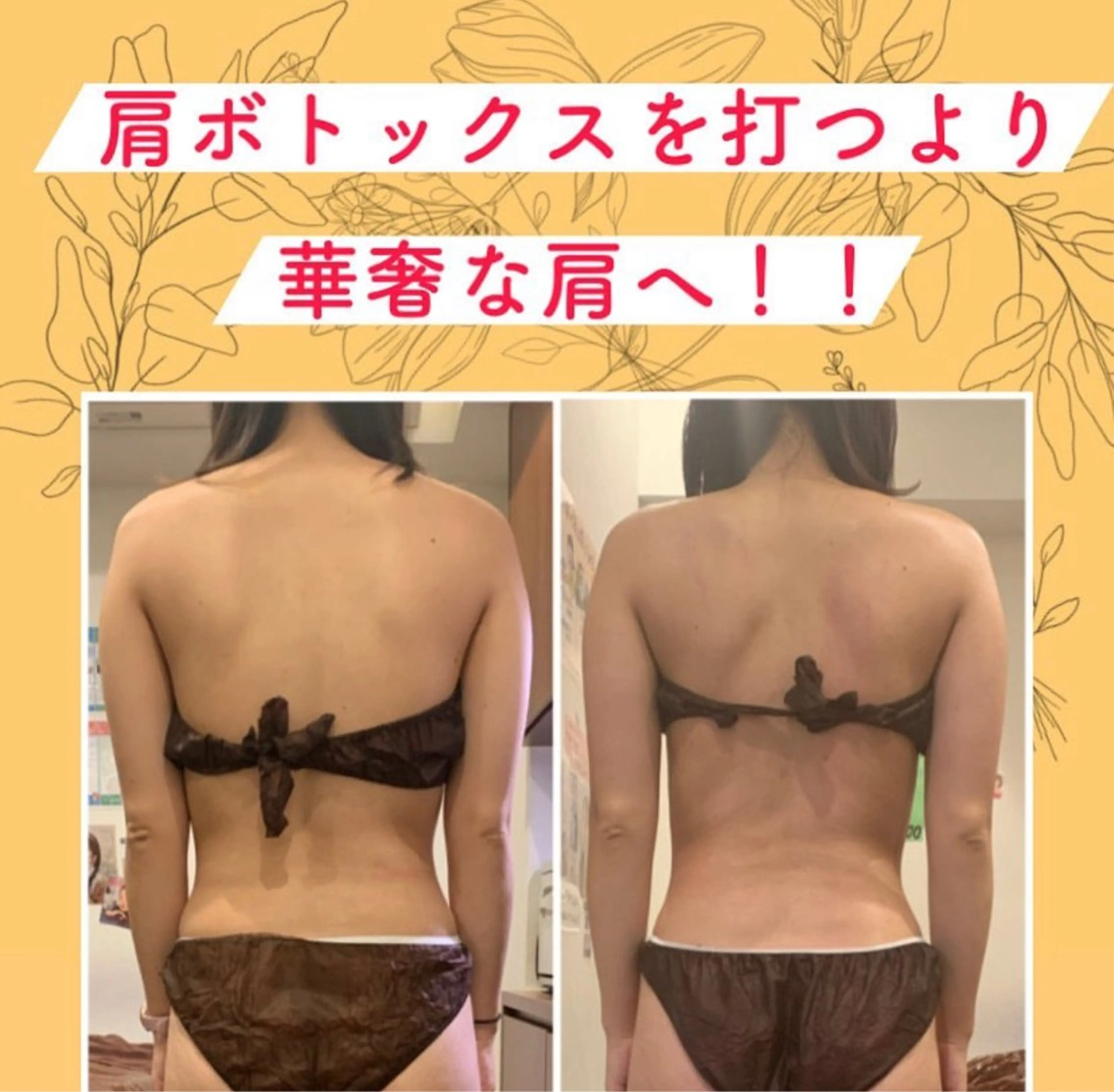 【肩凝りが悩みの方必見🔥】身体の深部から温めてコリを徹底的にほぐして華奢見え‼️の写真