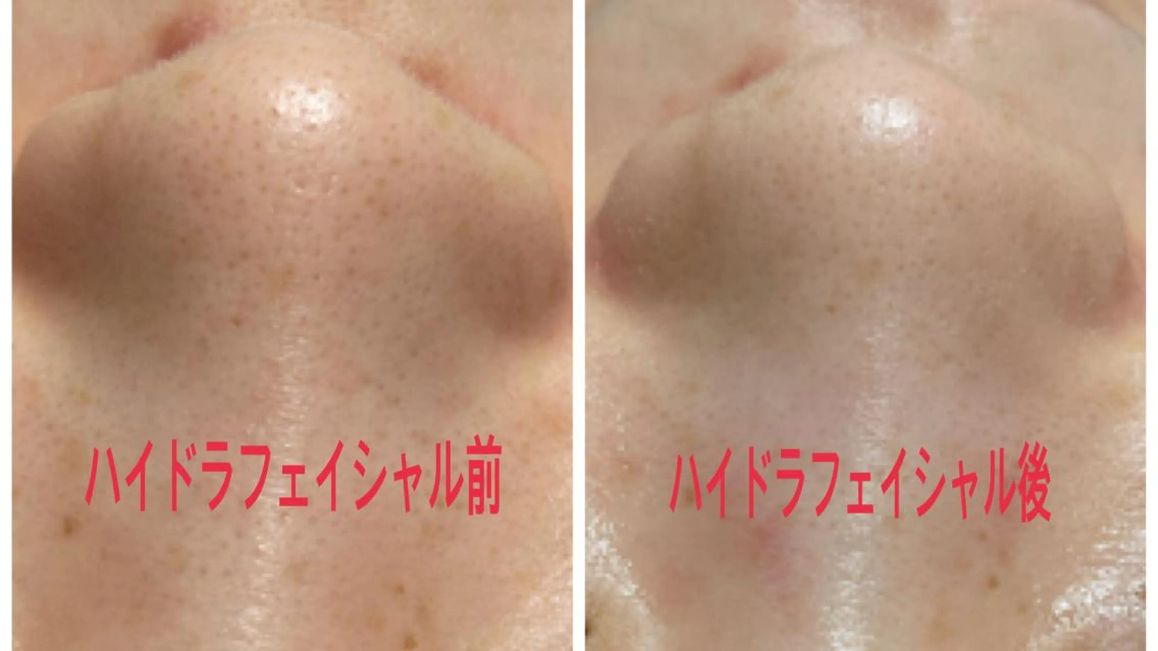 首・肩こり専門リンパ ケアサロンSENKAのエステ・リラクイメージ