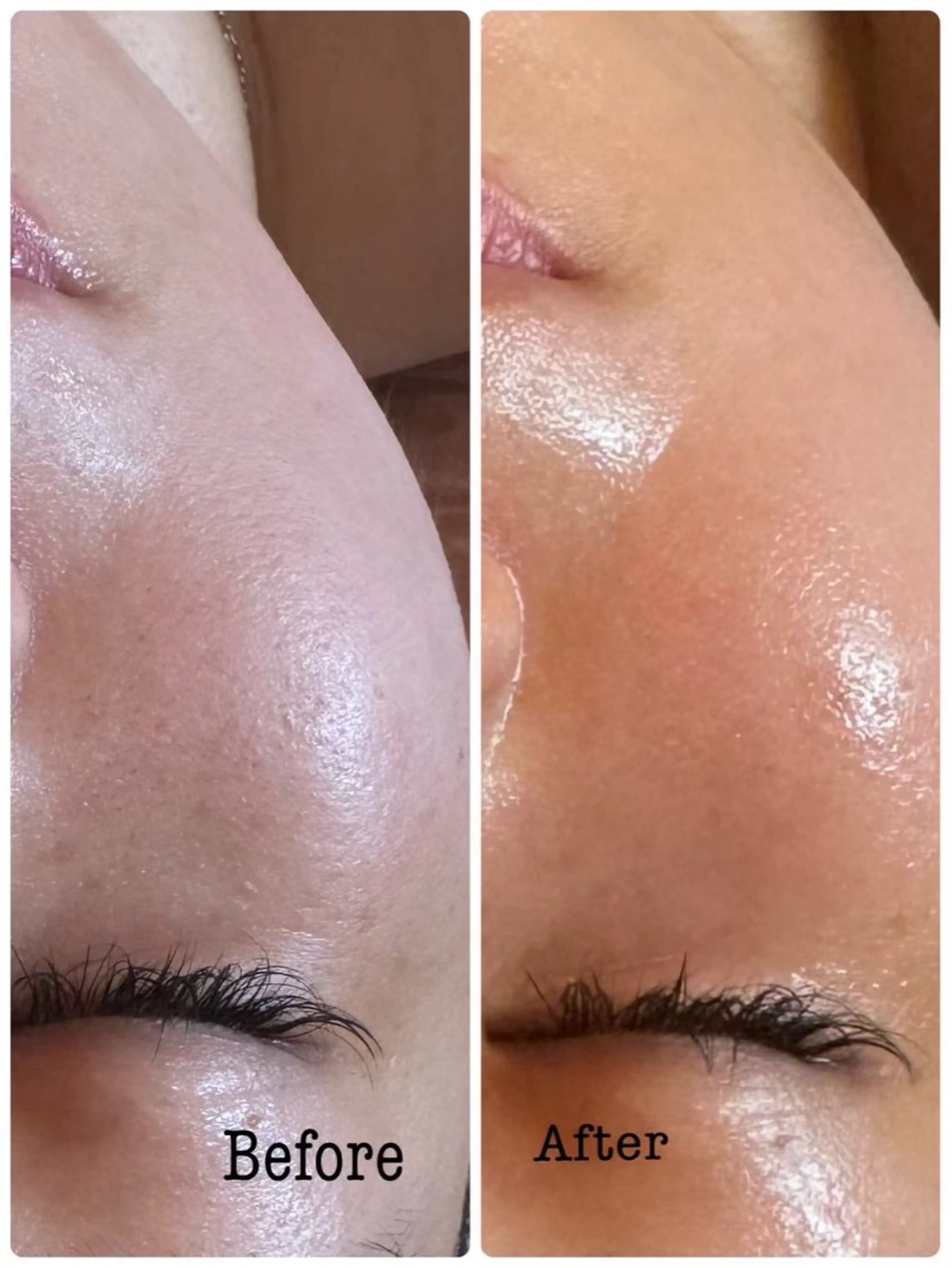 エステ グランジュテ所属・グランジュテ グランジュテのエステ・リラクイメージ