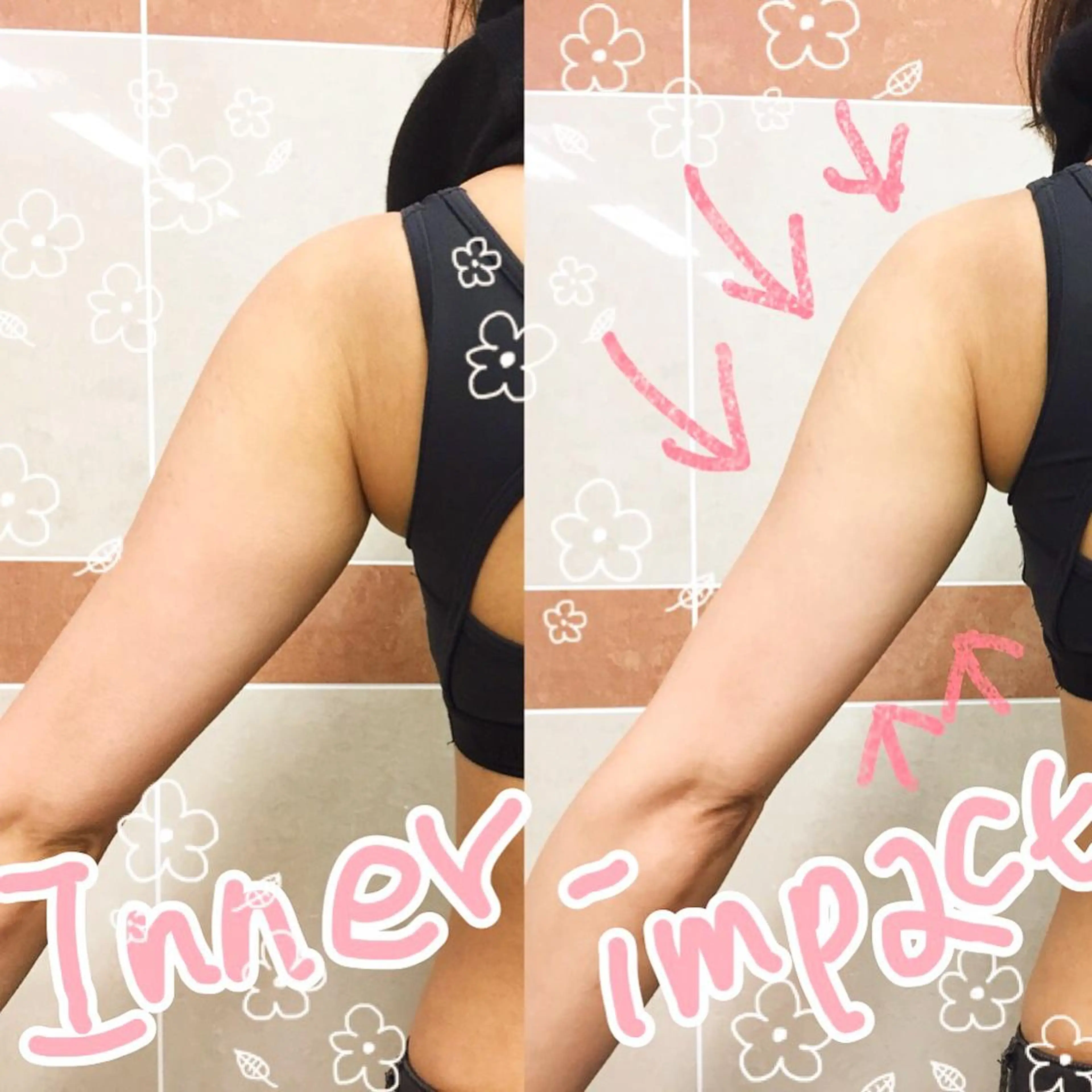 【ニキビ/肌管理】 salon varyのエステ・リラクイメージ