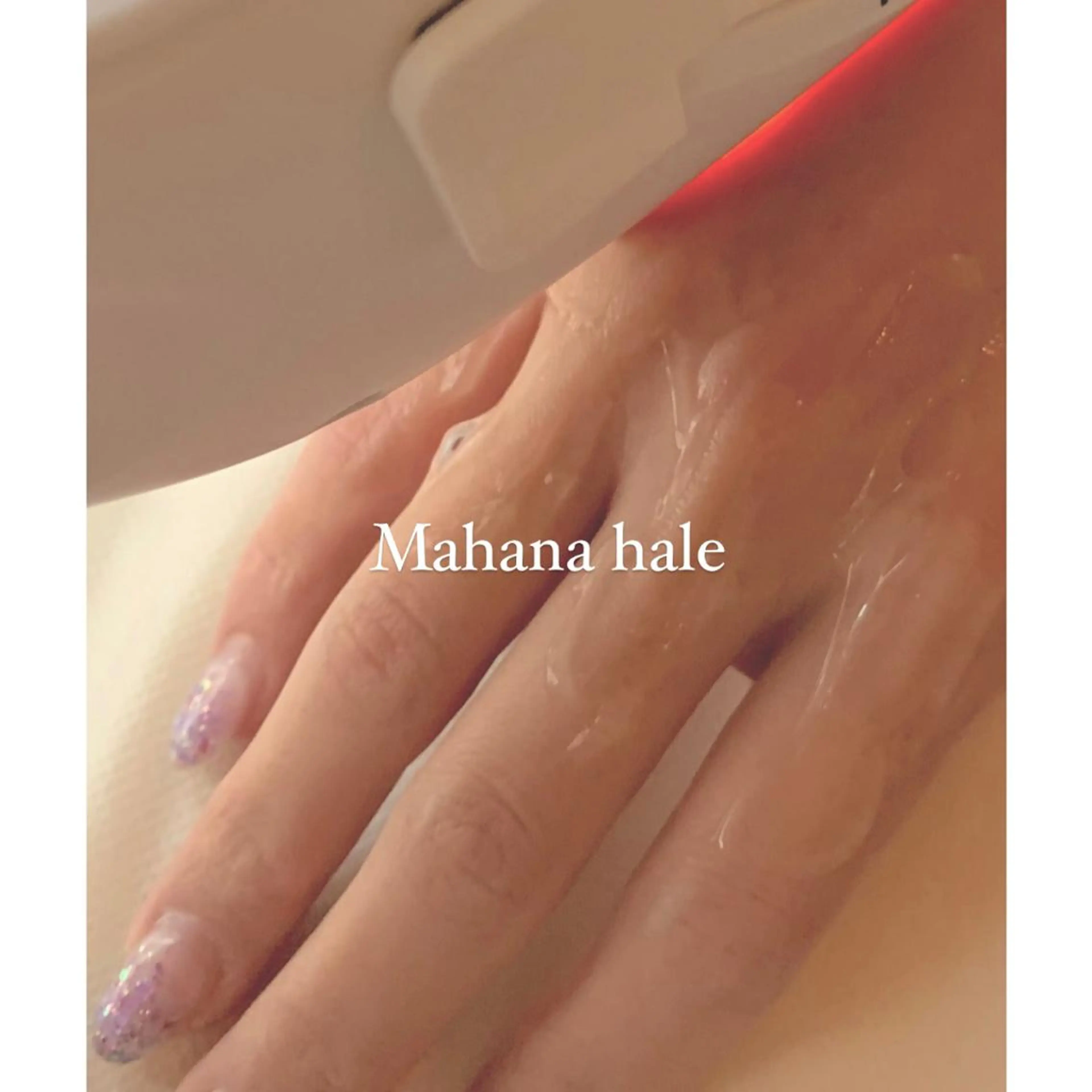 【光脱毛】Sパーツ(手の甲指、足の甲指、乳輪回り、へそ周り)の写真