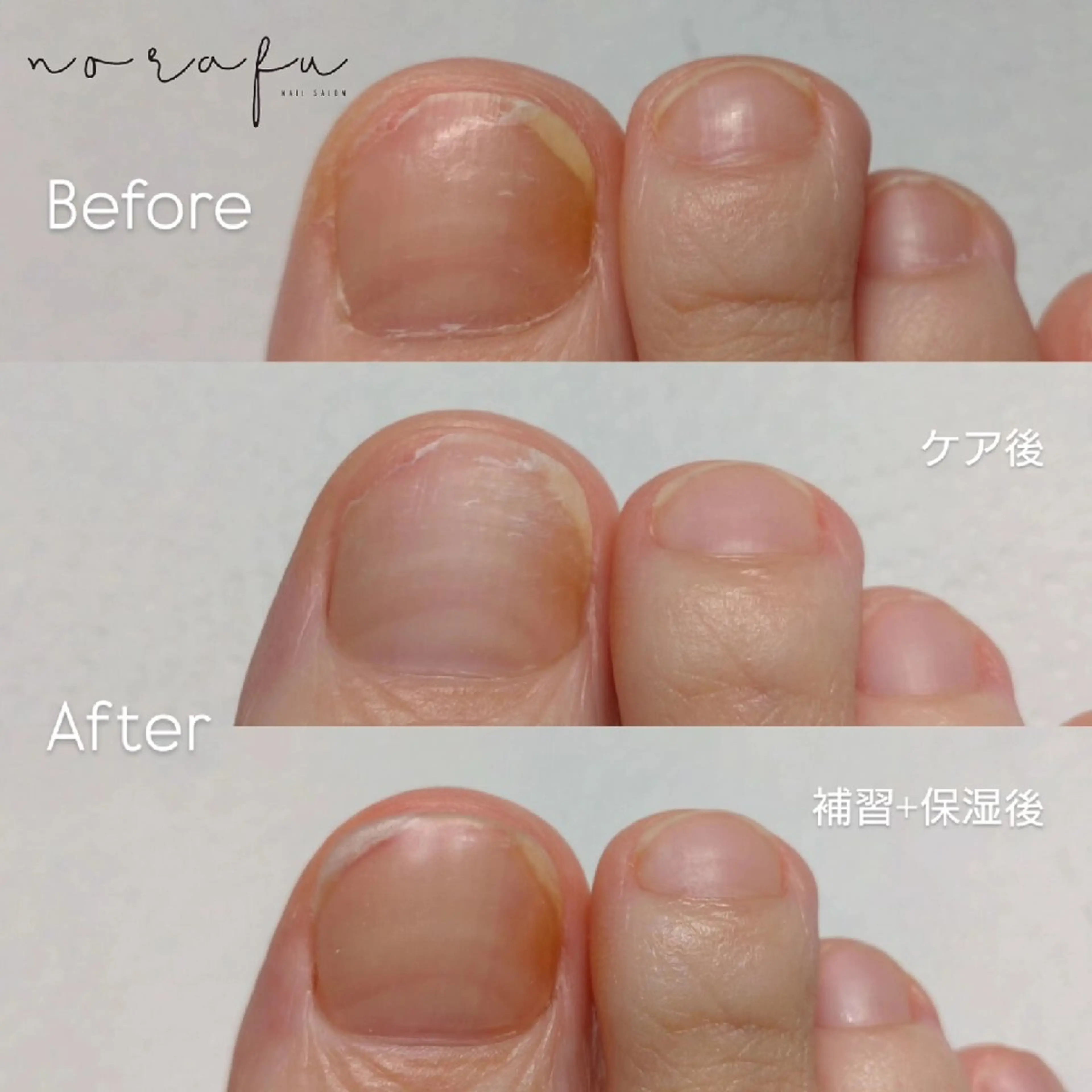 ネイル フットネイル norafu.所属・nail 　norafu.のネイルデザイン
