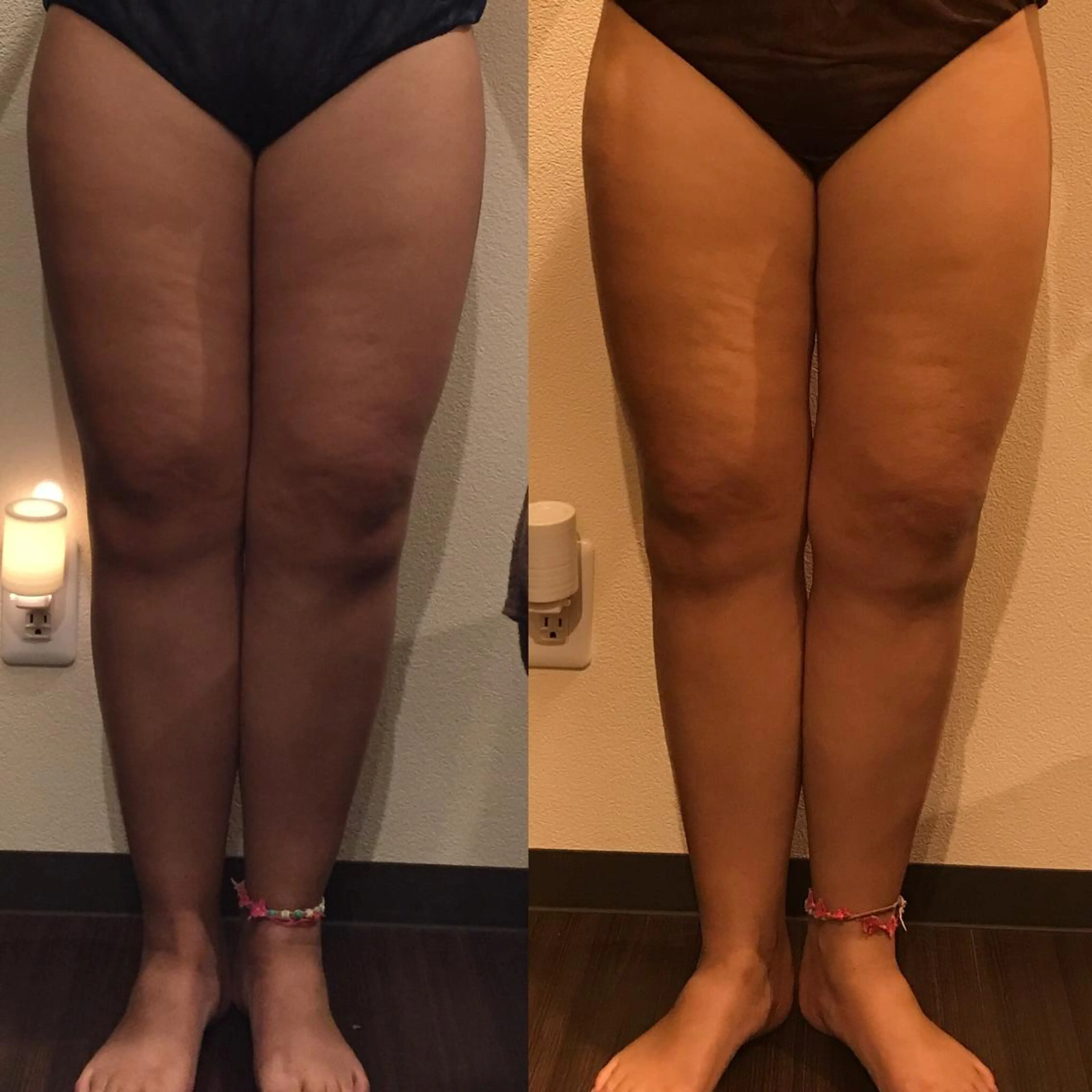 毒素出し専門サロンSylph(なかがわ整骨院併設サロン)所属・Mami Hataのエステ・リラクイメージ