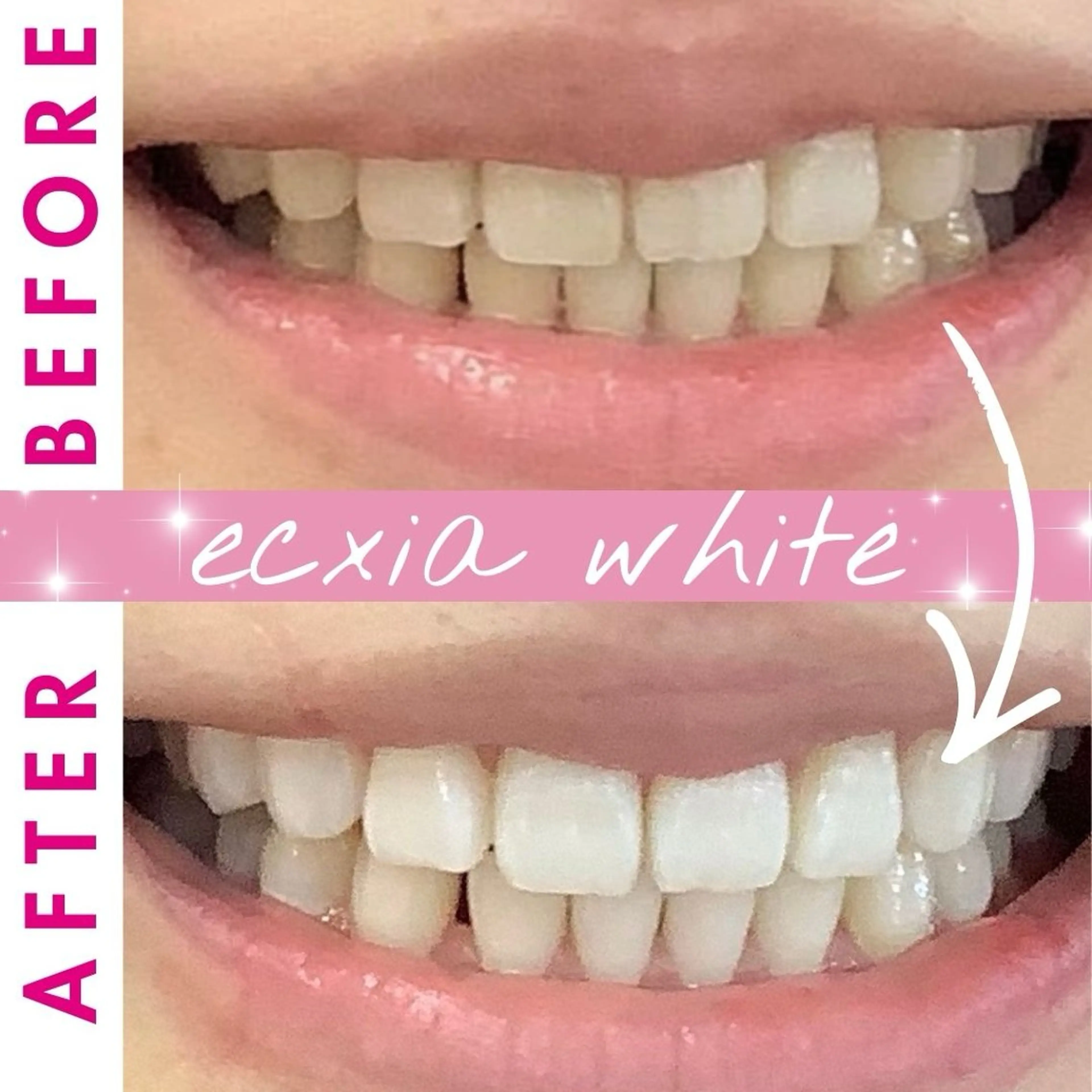 その他 セルフホワイトニングサロン　エクシアホワイト西尾店所属・エクシアホワイト西尾 堀内恵のその他イメージ