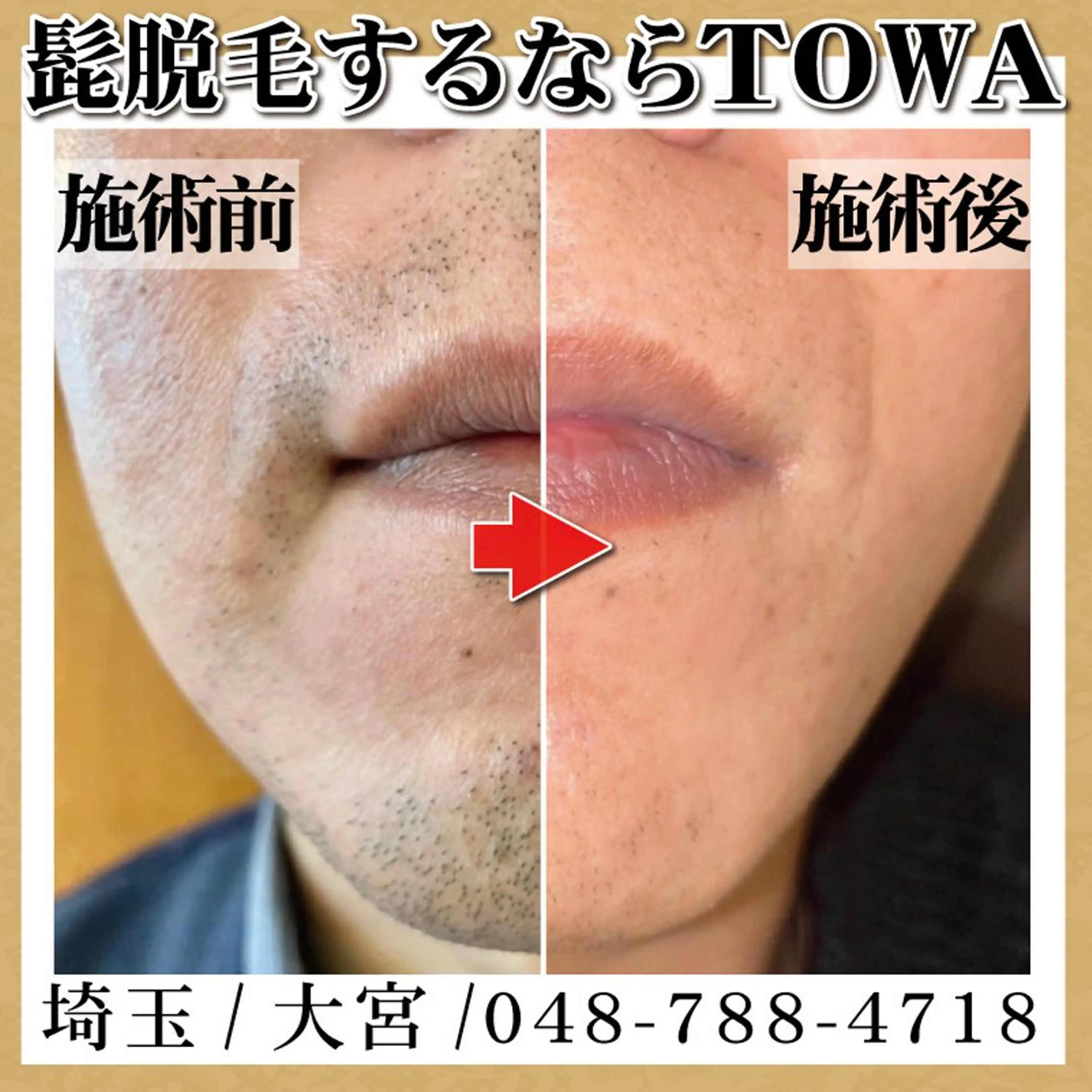 脱毛＆フェイシャル TOWA大宮のエステ・リラクイメージ