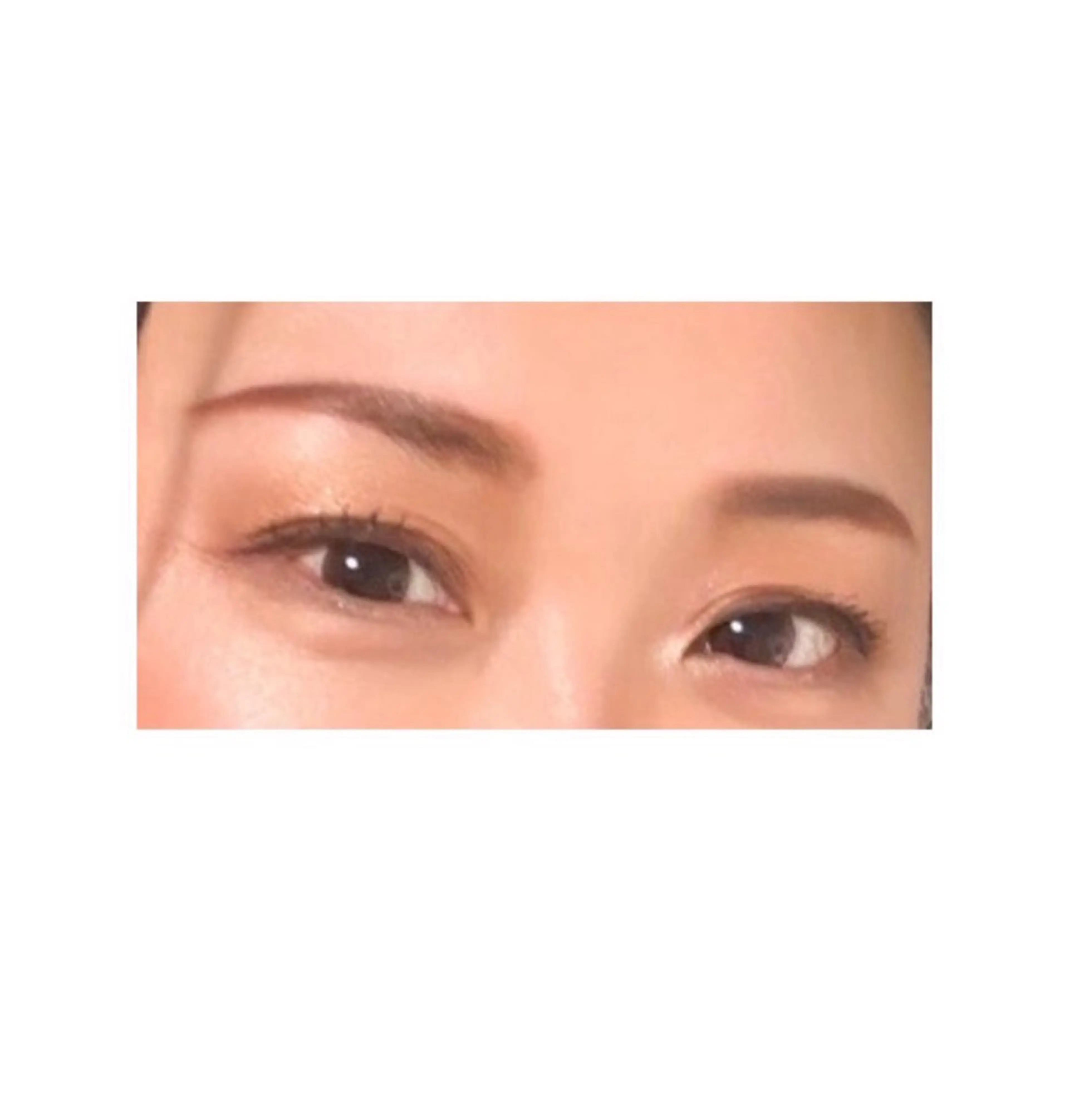 脱毛 透明感の肌Lino malieのエステ・リラクイメージ