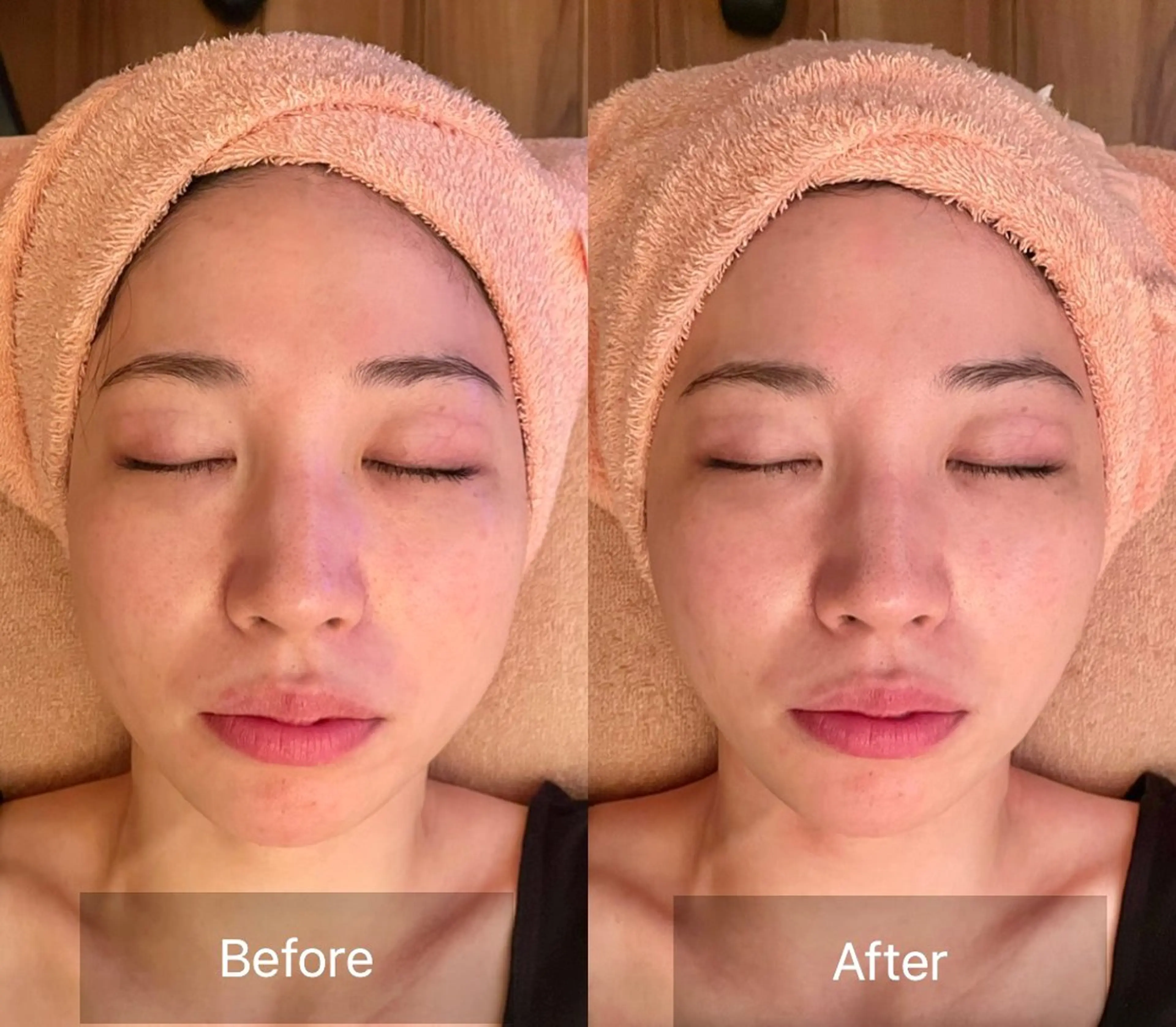 アイブロウ/脱毛/ 肌質改善🌷RINAの眉毛・アイブロウイメージ