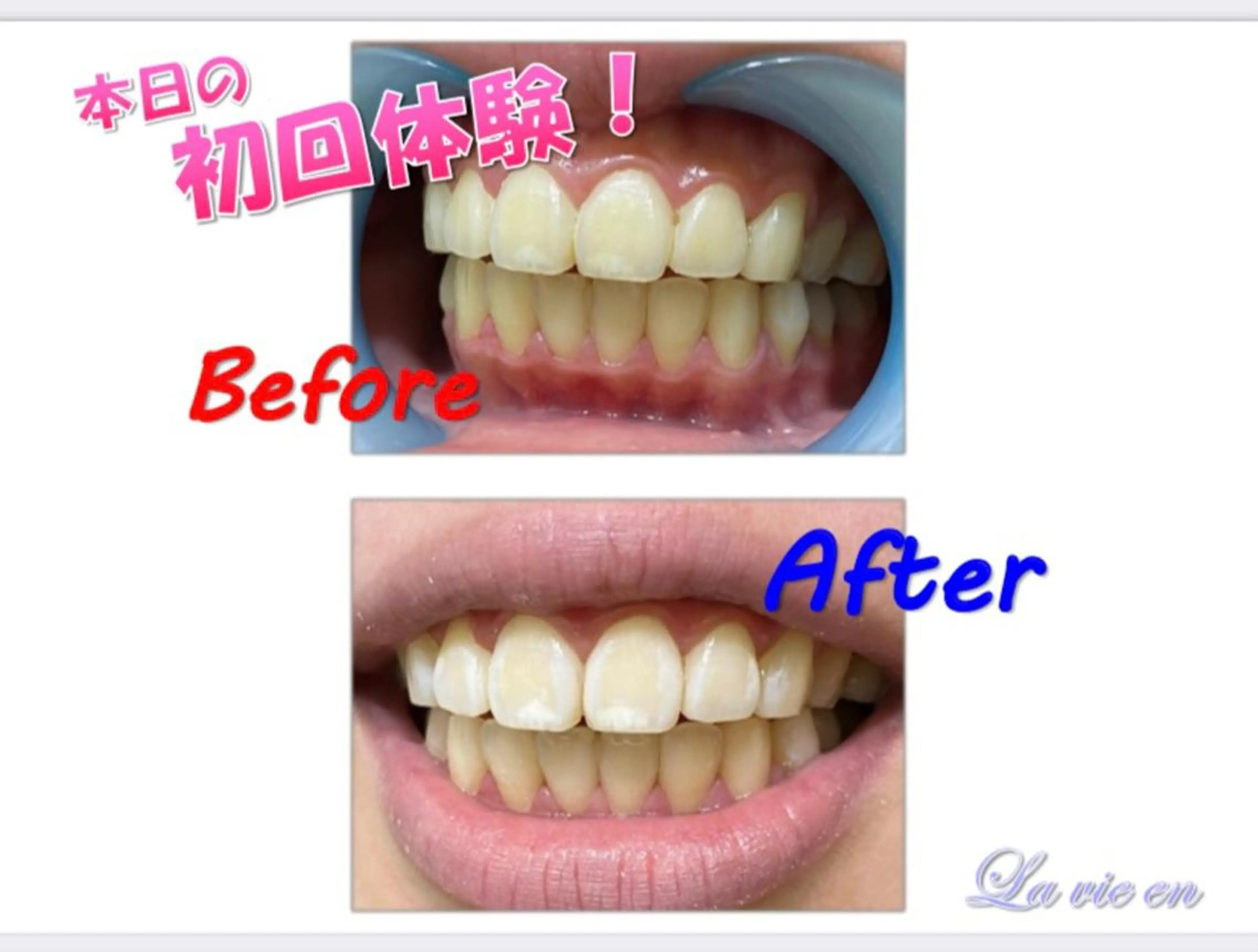 その他 セルフホワイトニングサロン　ラヴィアン所属・ホワイトニングサロン La vie enのその他イメージ