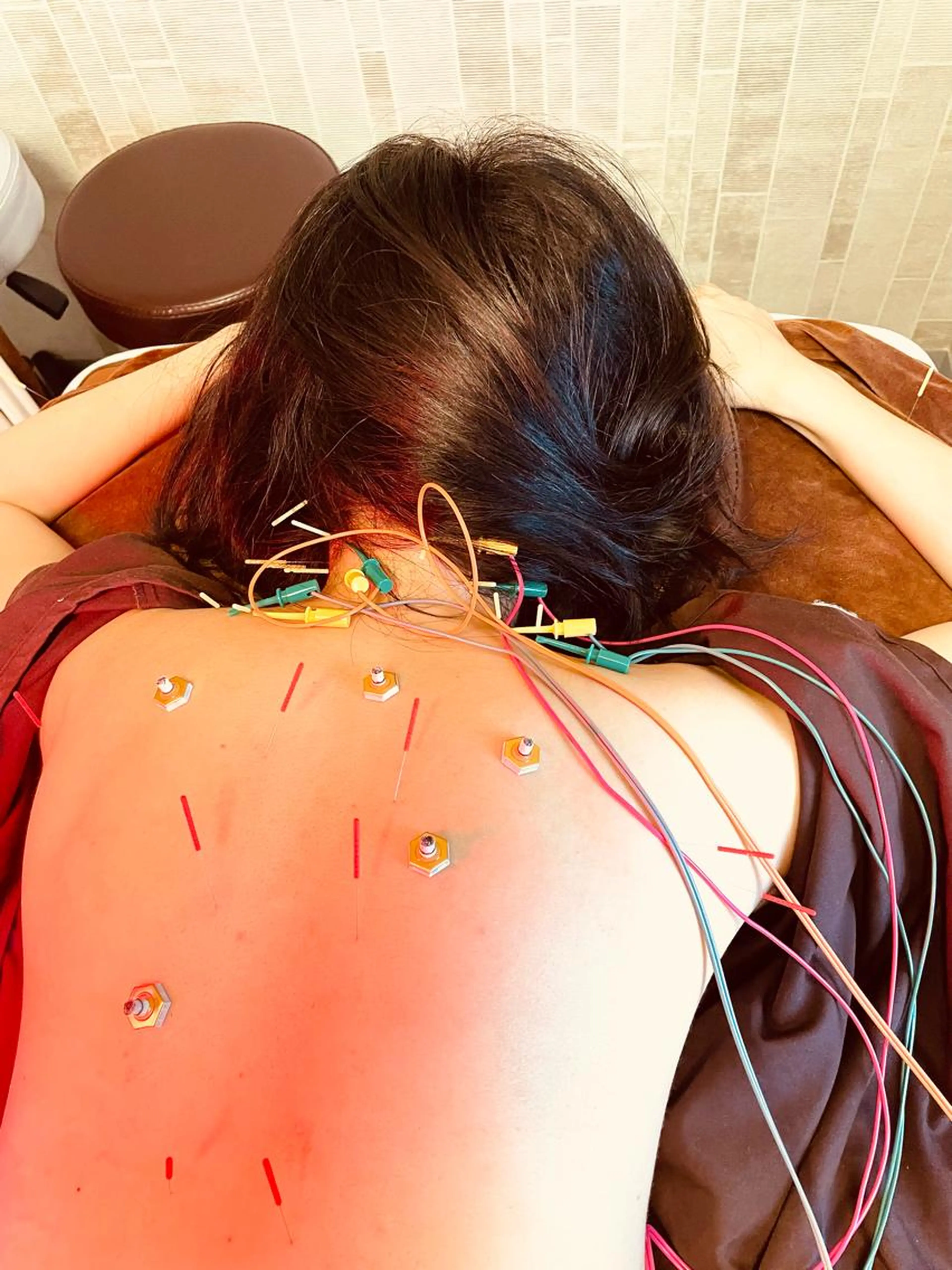 90分【全身鍼＋気になる部位マッサージ】首肩こり腰痛、ホルモンバランス、全身疲労、不眠、マッサージorオイルマッサージの写真