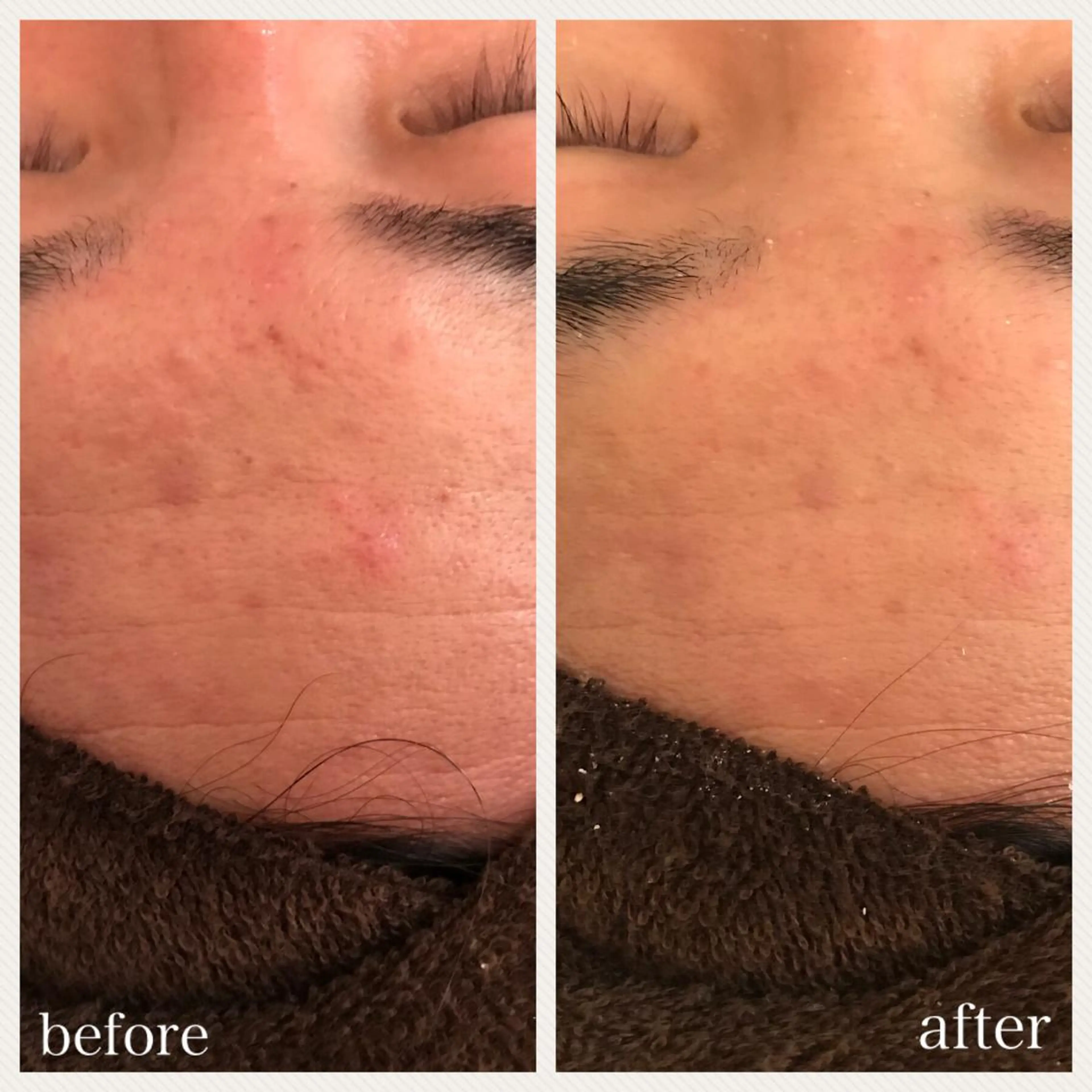 ショート マツエク・マツパ エステ リラク ニキビ跡専門サロン Ａｉｎａのエステ・リラクイメージ