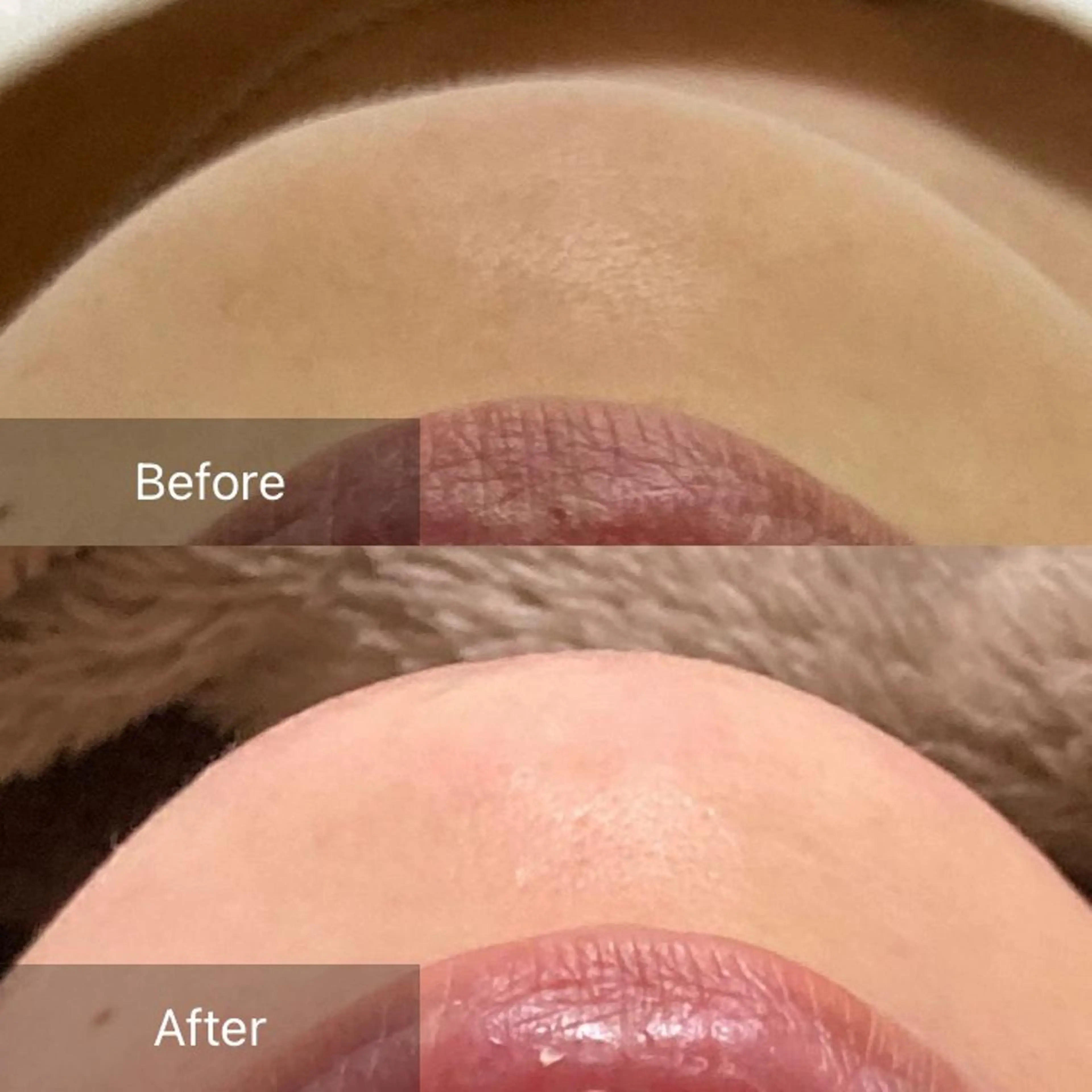 脱毛 産毛専門店 Bittoのエステ・リラクイメージ