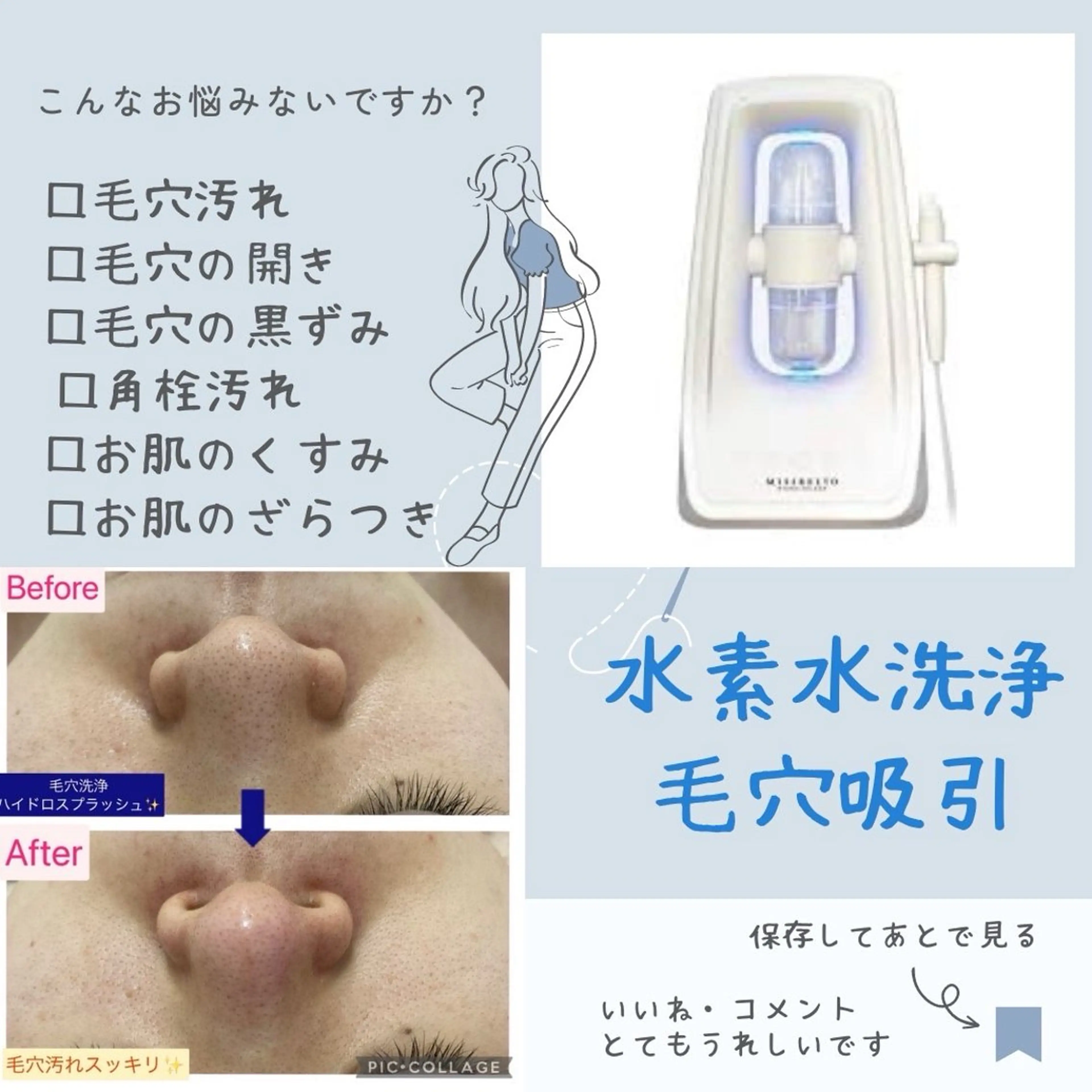 ごっそり毛穴汚れとり！毛穴洗浄ハイドロ×美白マスク【毛穴の角栓汚れ・いちご鼻の黒ずみ・毛穴のひらき】水素の力でくすみも◎の写真