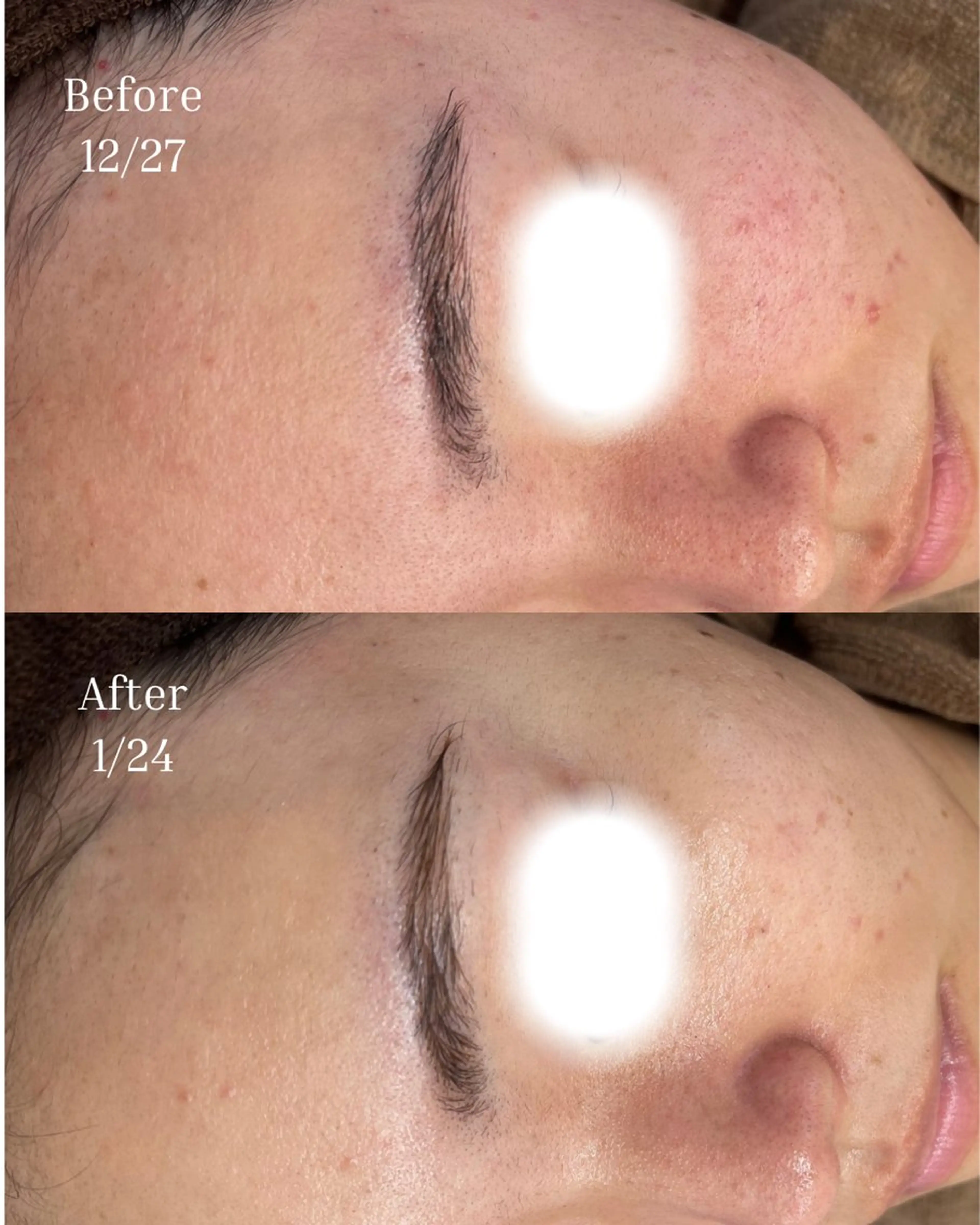 BELLIS HUIT所属・ハーブピーリング那覇 BELLISHUITのエステ・リラクイメージ