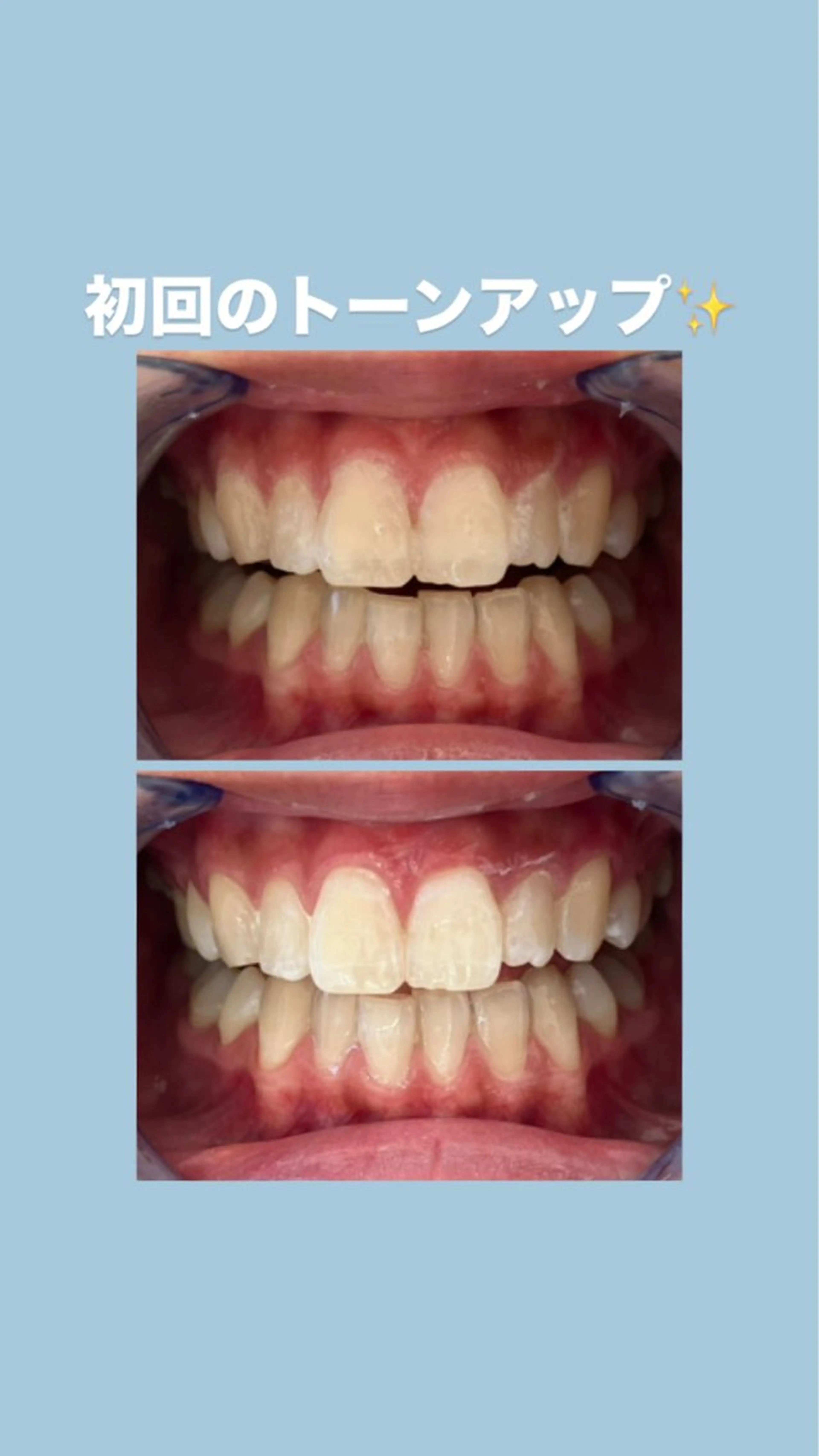 セルフホワイトニングサロンエクシアホワイト倉敷店所属・ecxiawhite 倉敷店のエステ・リラクイメージ