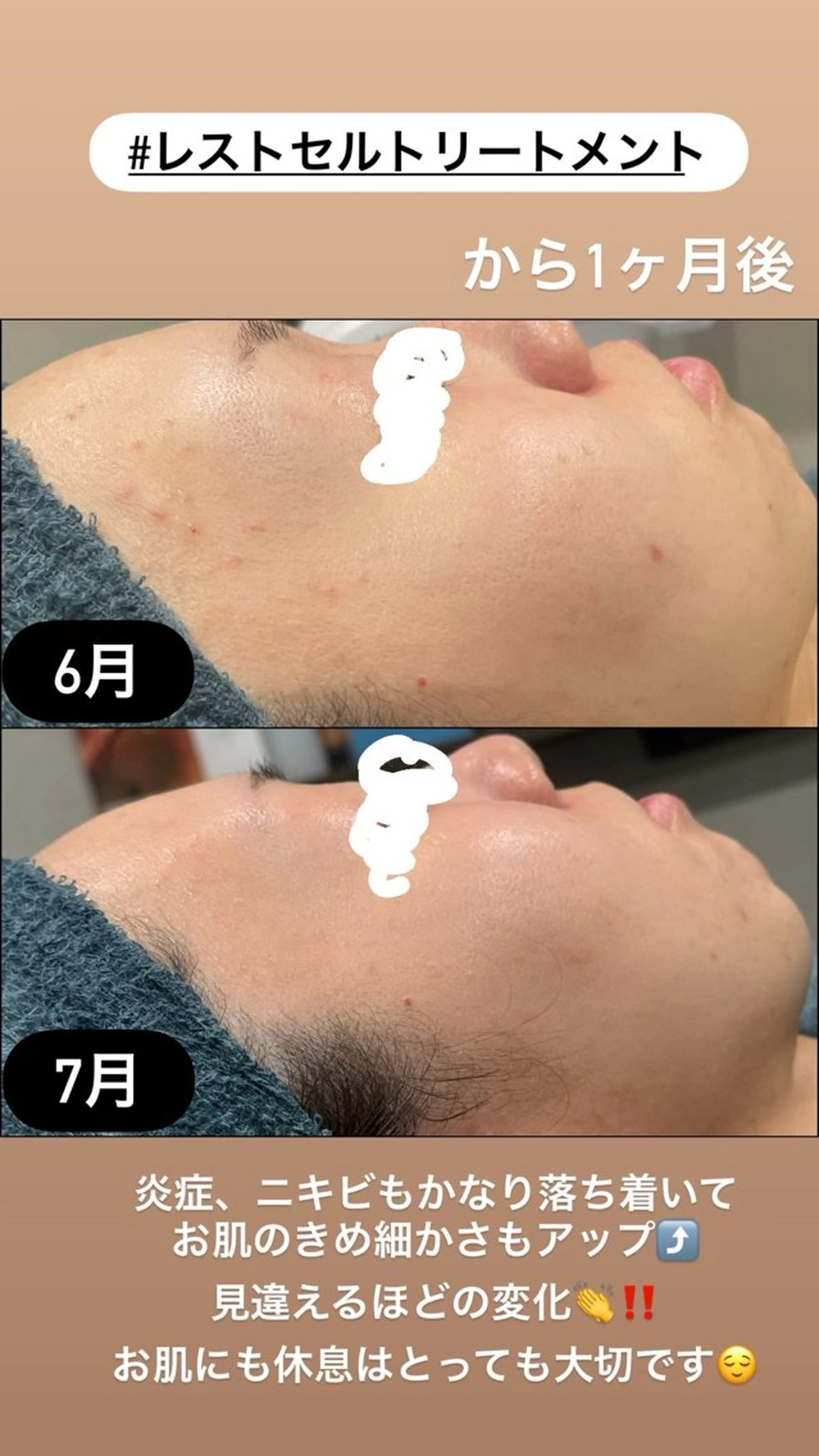 エステ LiZA エステティックサロンのエステ・リラクイメージ