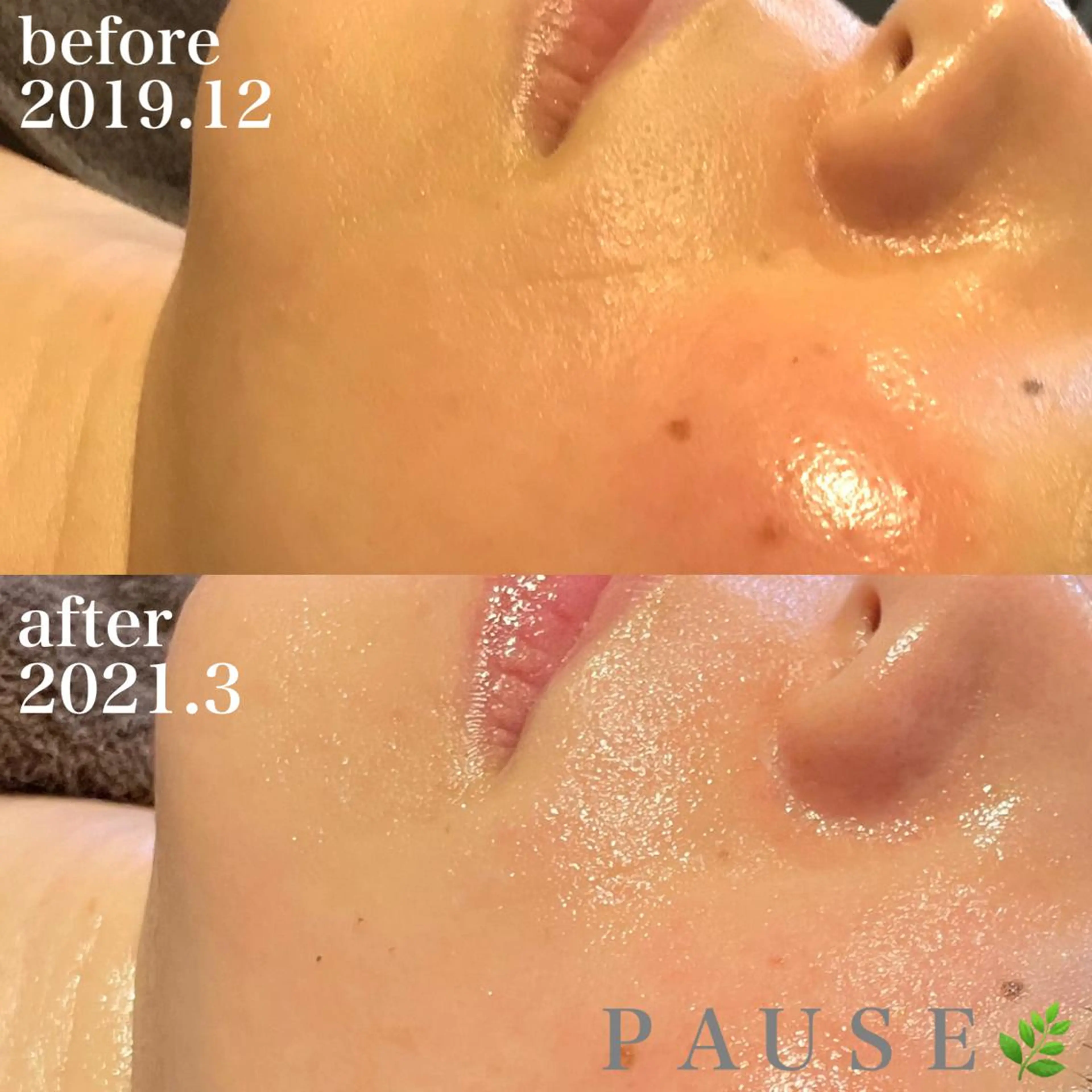 エステ リラク 浜野 恵美のエステ・リラクイメージ