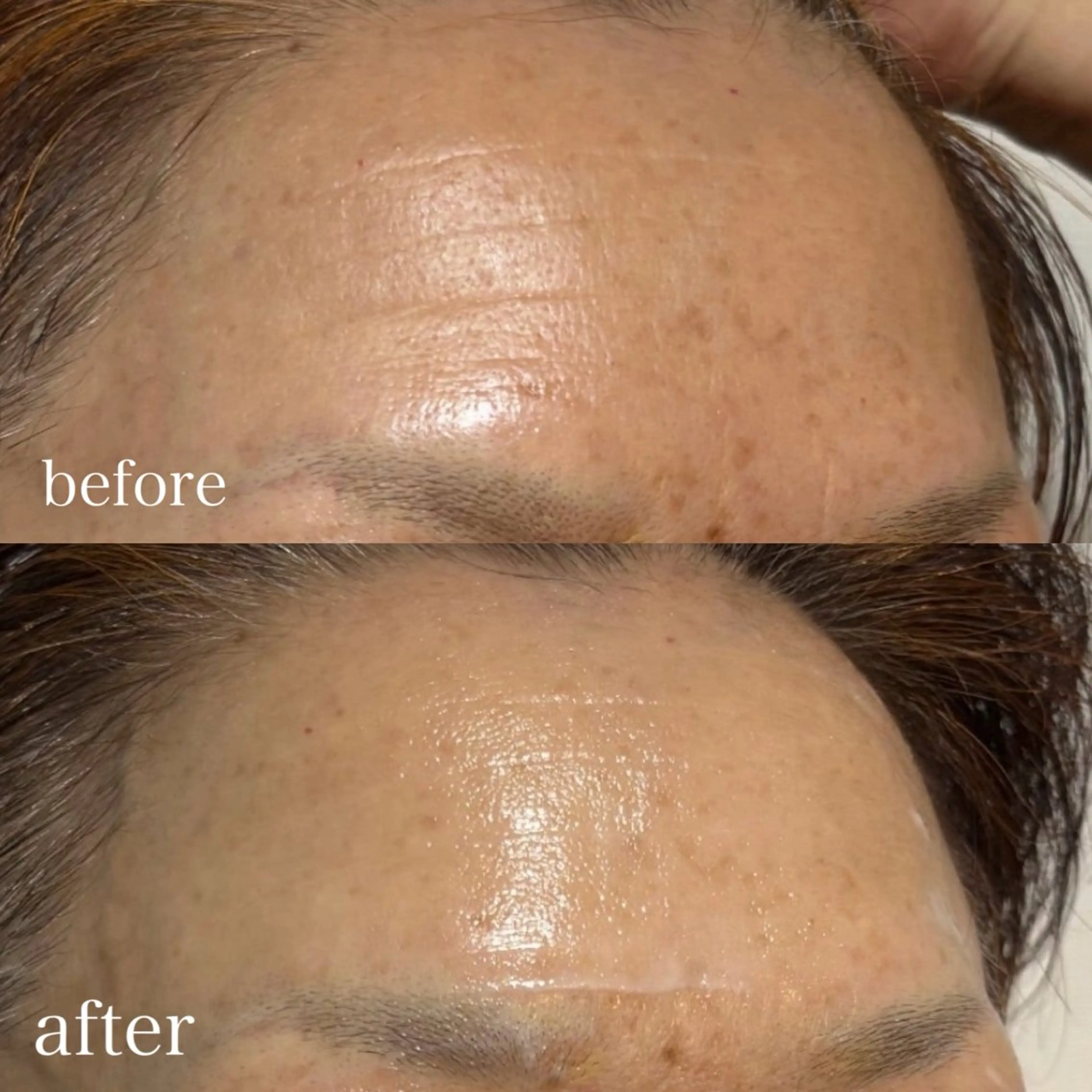 エステ Salon de sharmant所属・岡 本のエステ・リラクイメージ