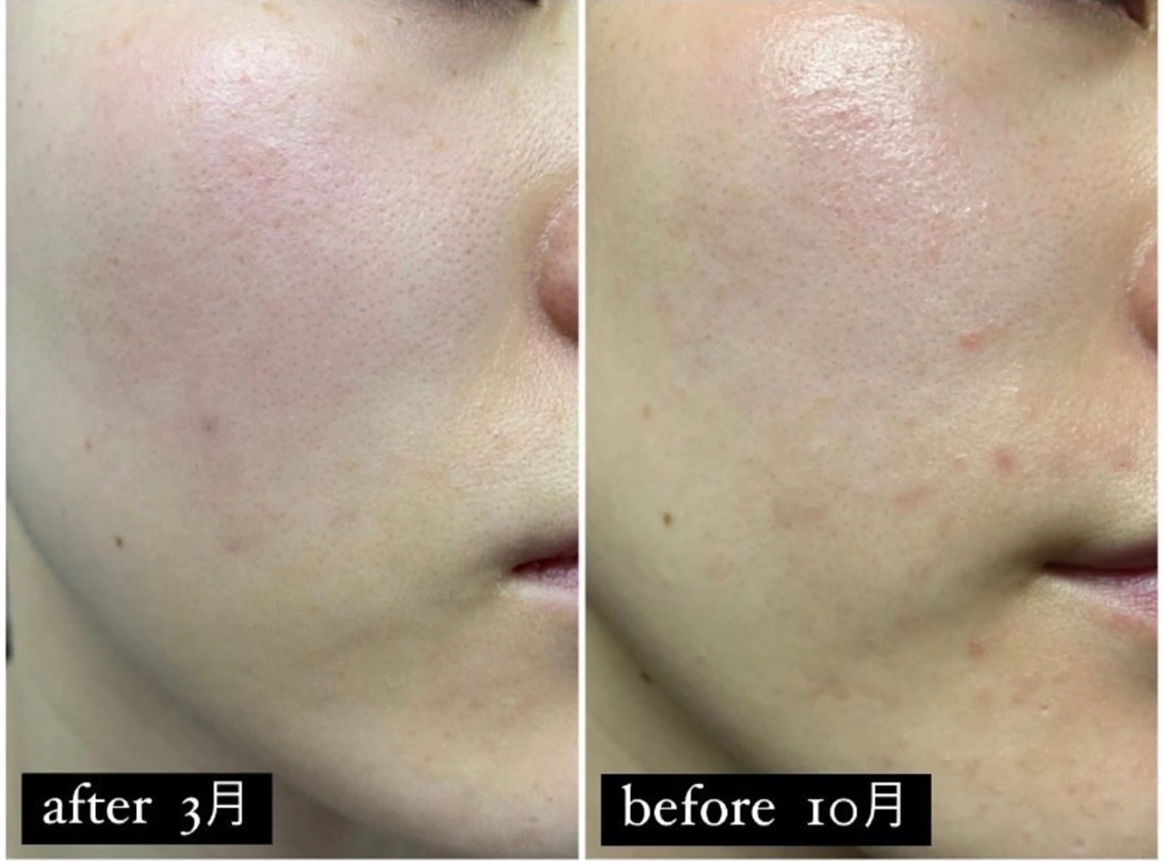 reve .のエステ・リラクイメージ