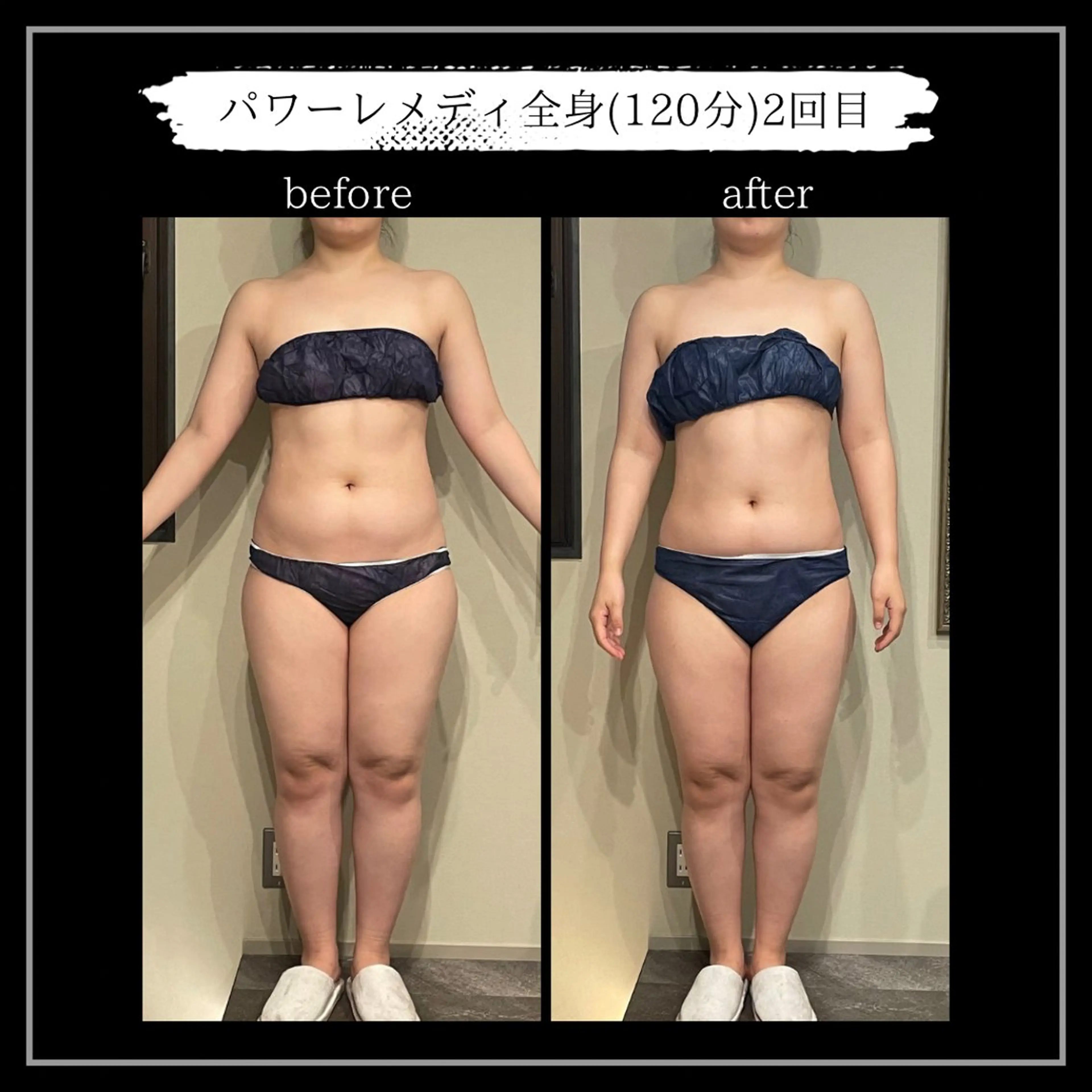 オフ:オン所属・オフ:オン 全身筋膜マッサージのエステ・リラクイメージ