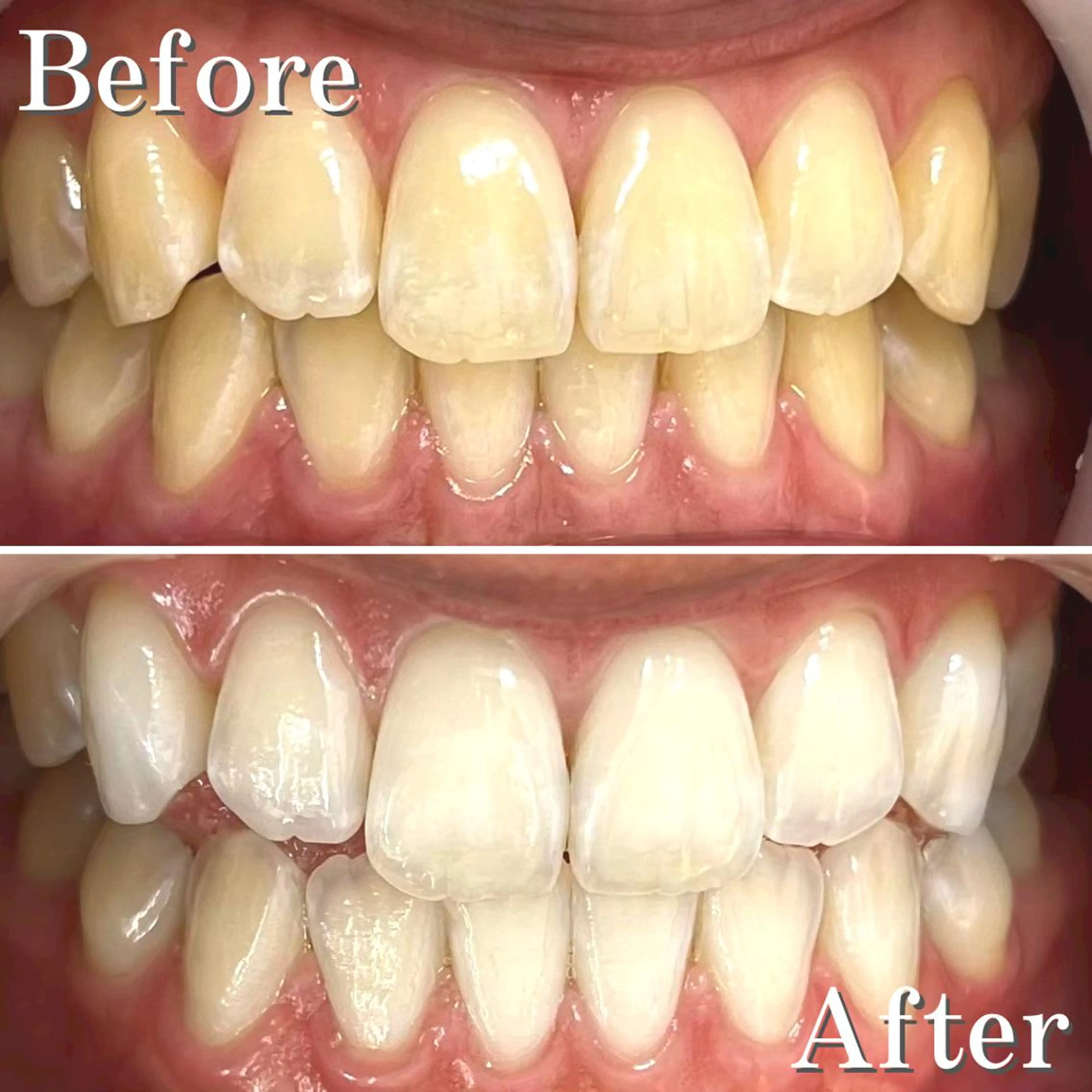 ロング ヘアアレンジ メンズ カラー パーマ ネイル アイブロウ マツエク・マツパ 結婚式・ブライダル メンズアイブロウ 結婚式・ブライダル メンズネイル ブライダルネイル エステ リラク LBSホワイトニング 銀座店💎店長浦和のその他イメージ