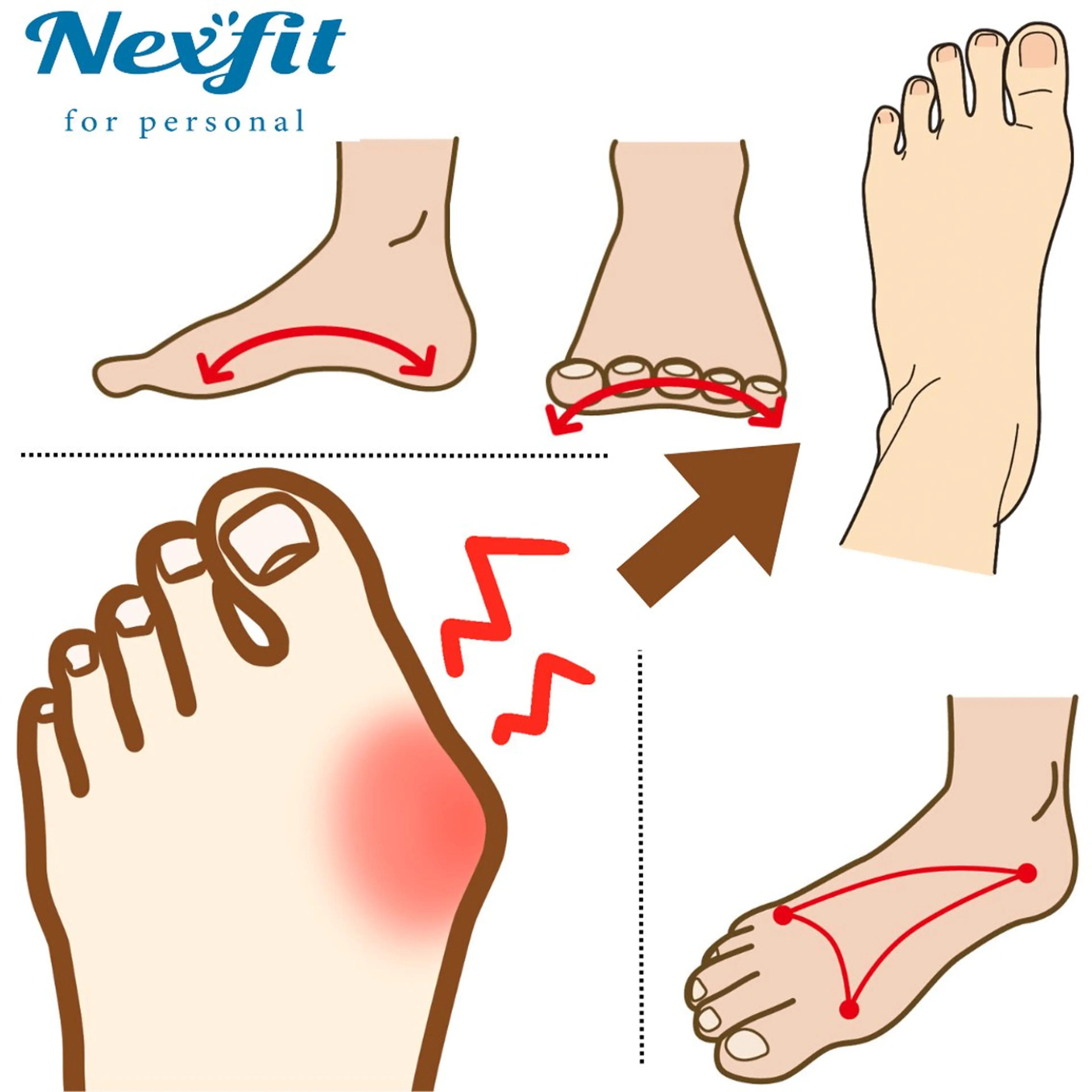 【外反母趾】オールハンド筋膜リリースによる《外反母趾改善施術》の撮影モデルさん募集!の写真