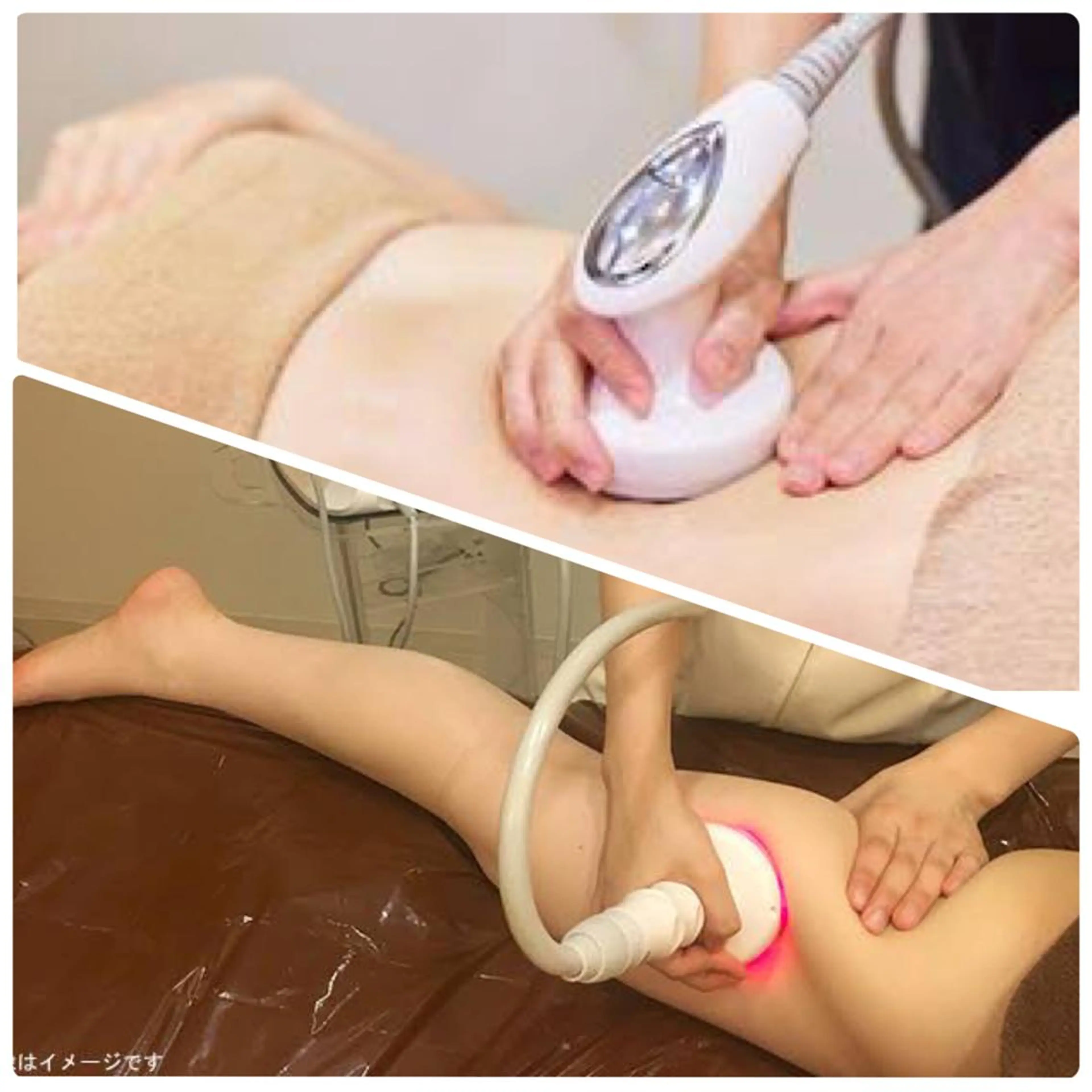 【🎄12月限定】🔥凸凹セルライト×全身痩せ🔥　★3980円→2980円★　《1台で5役マシーン》の写真