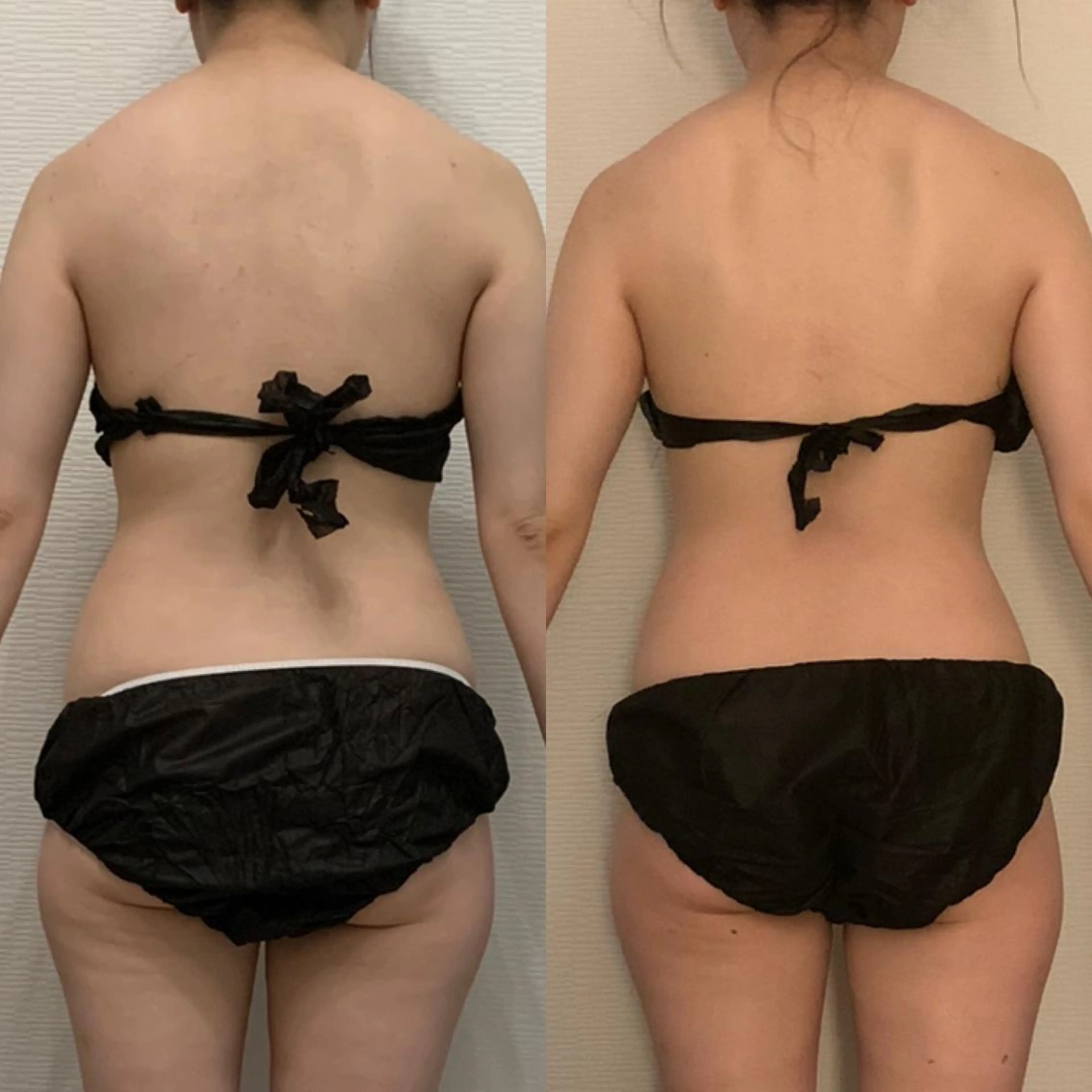 エステ リラク R.M所属・プライベートサロン R.Mのエステ・リラクイメージ