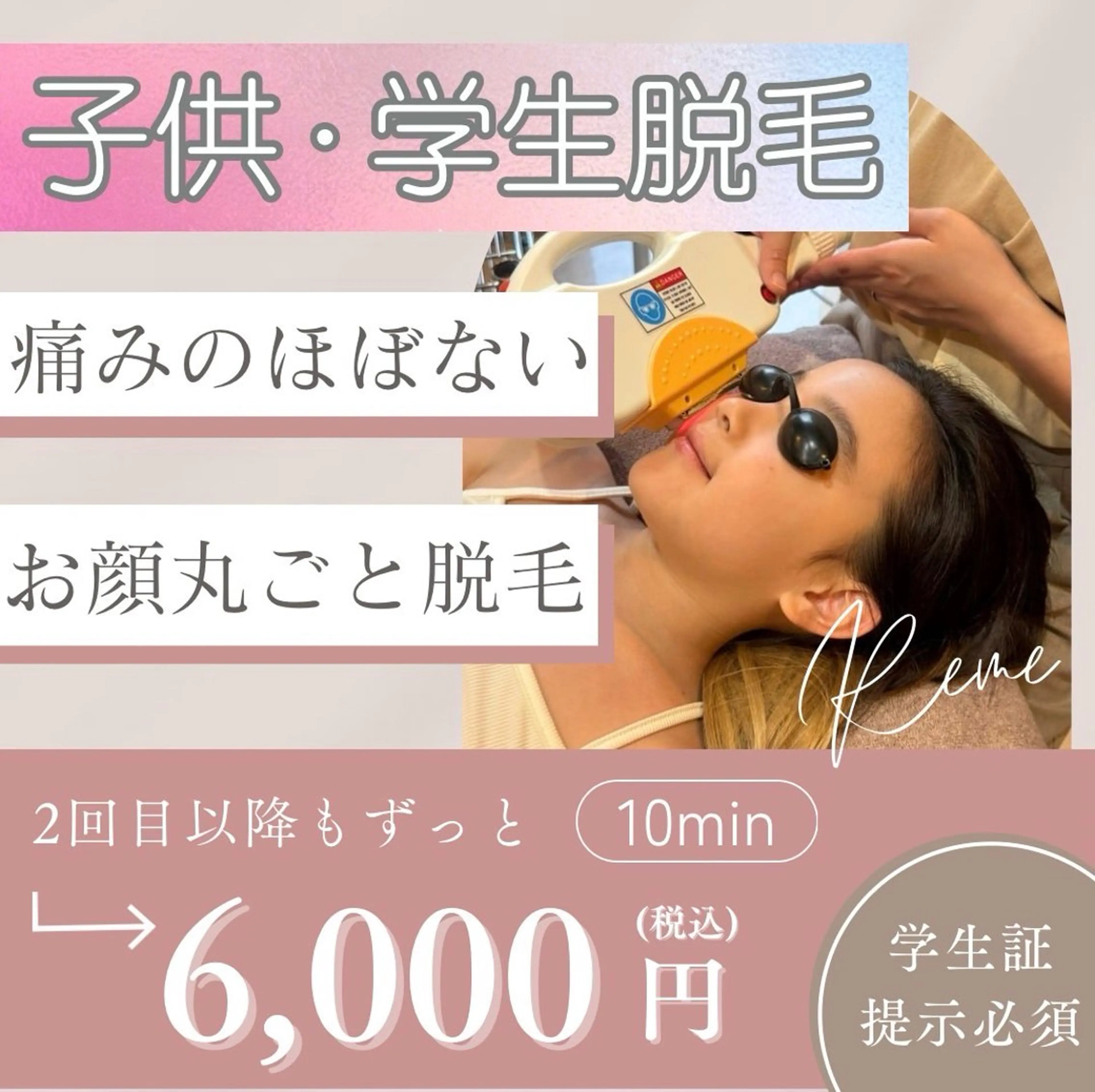 【美肌効果◎】お顔丸ごと脱毛(約10分)¥6000の写真