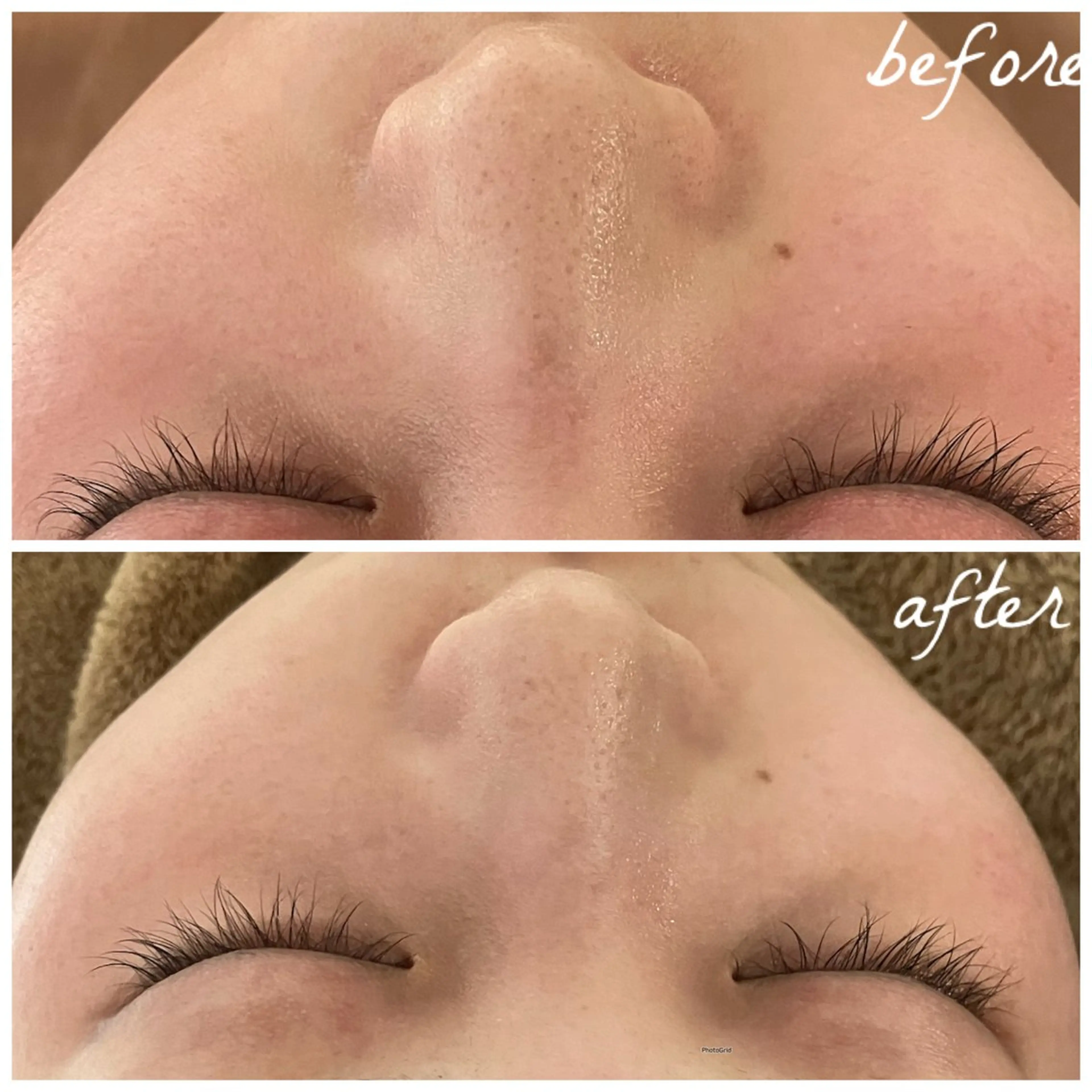 メンズ エステ メナード岐阜茜部 杉浦のエステ・リラクイメージ