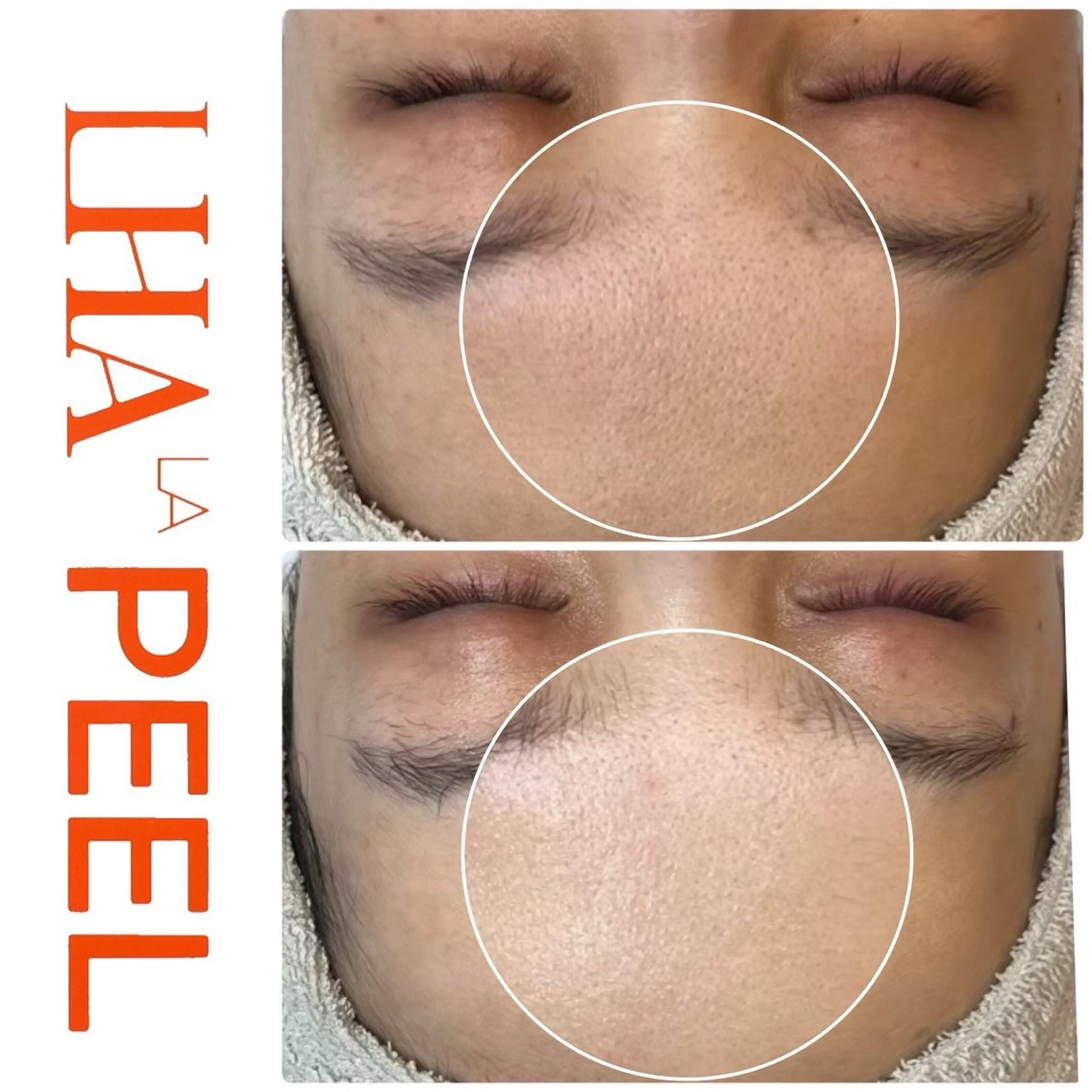 エステ ハーブピーリング専門 BIOEL横浜のエステ・リラクイメージ