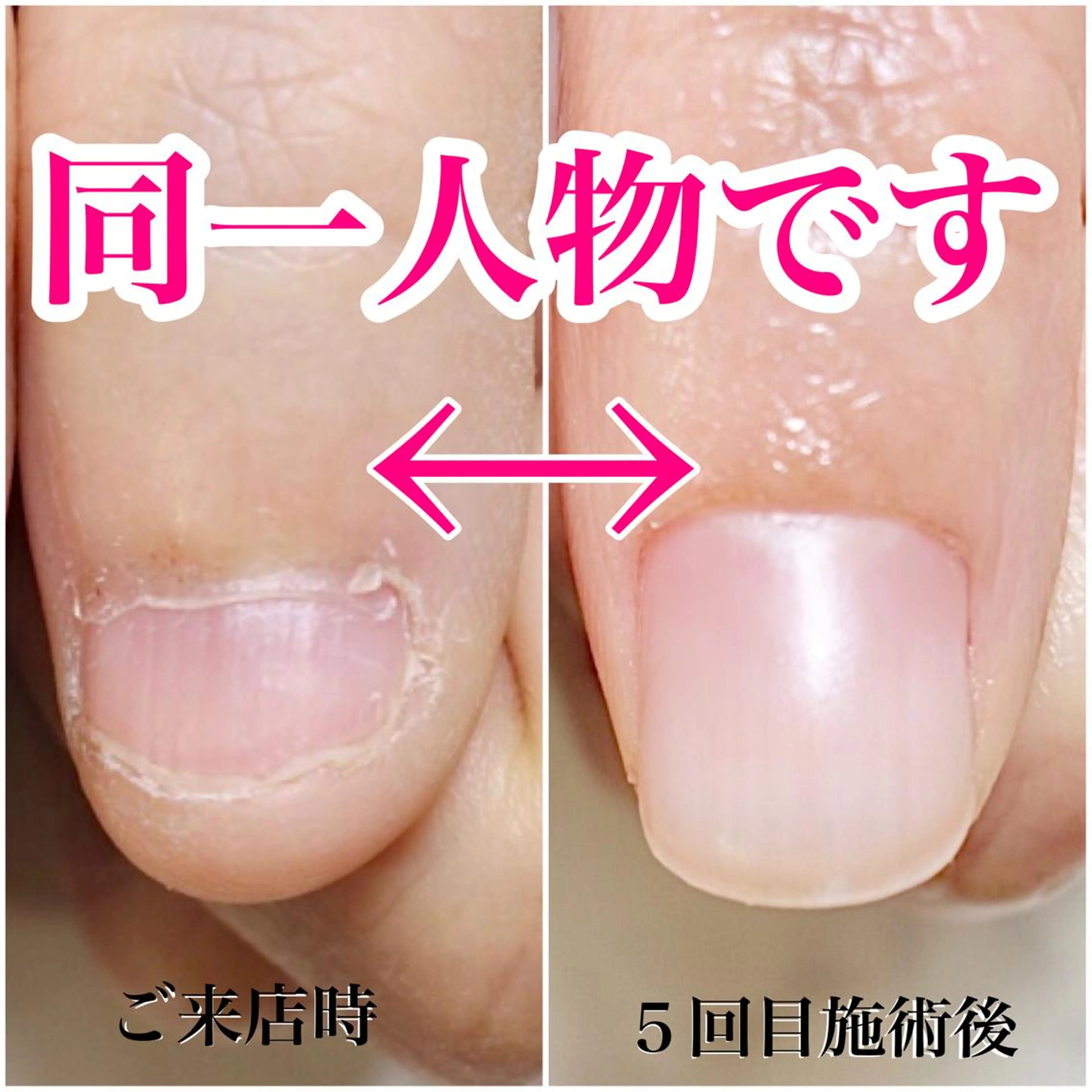 ネイル nailsalon VENUSのネイルデザイン