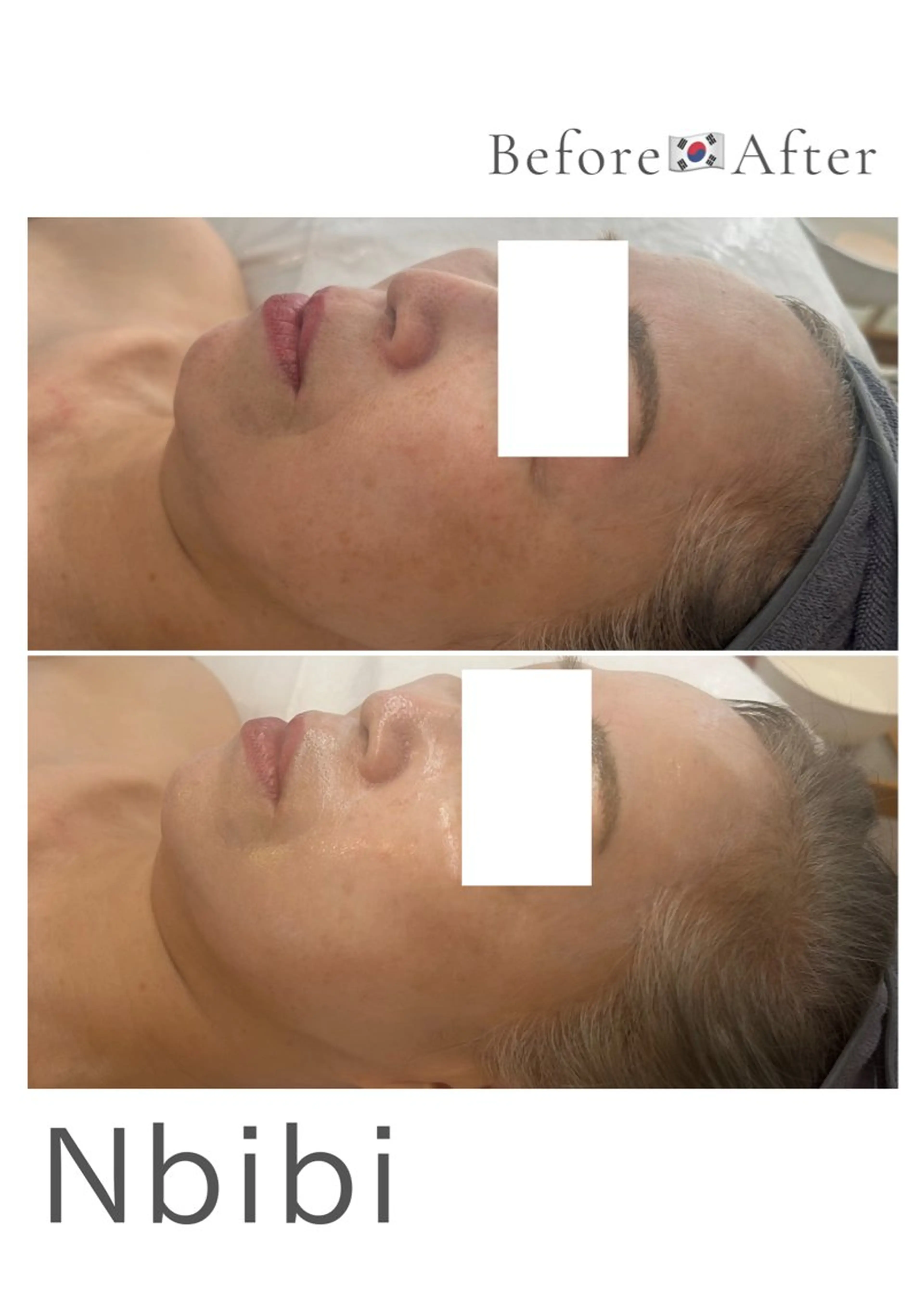 韓国🇰🇷価格 サロン_Nbibiのエステ・リラクイメージ