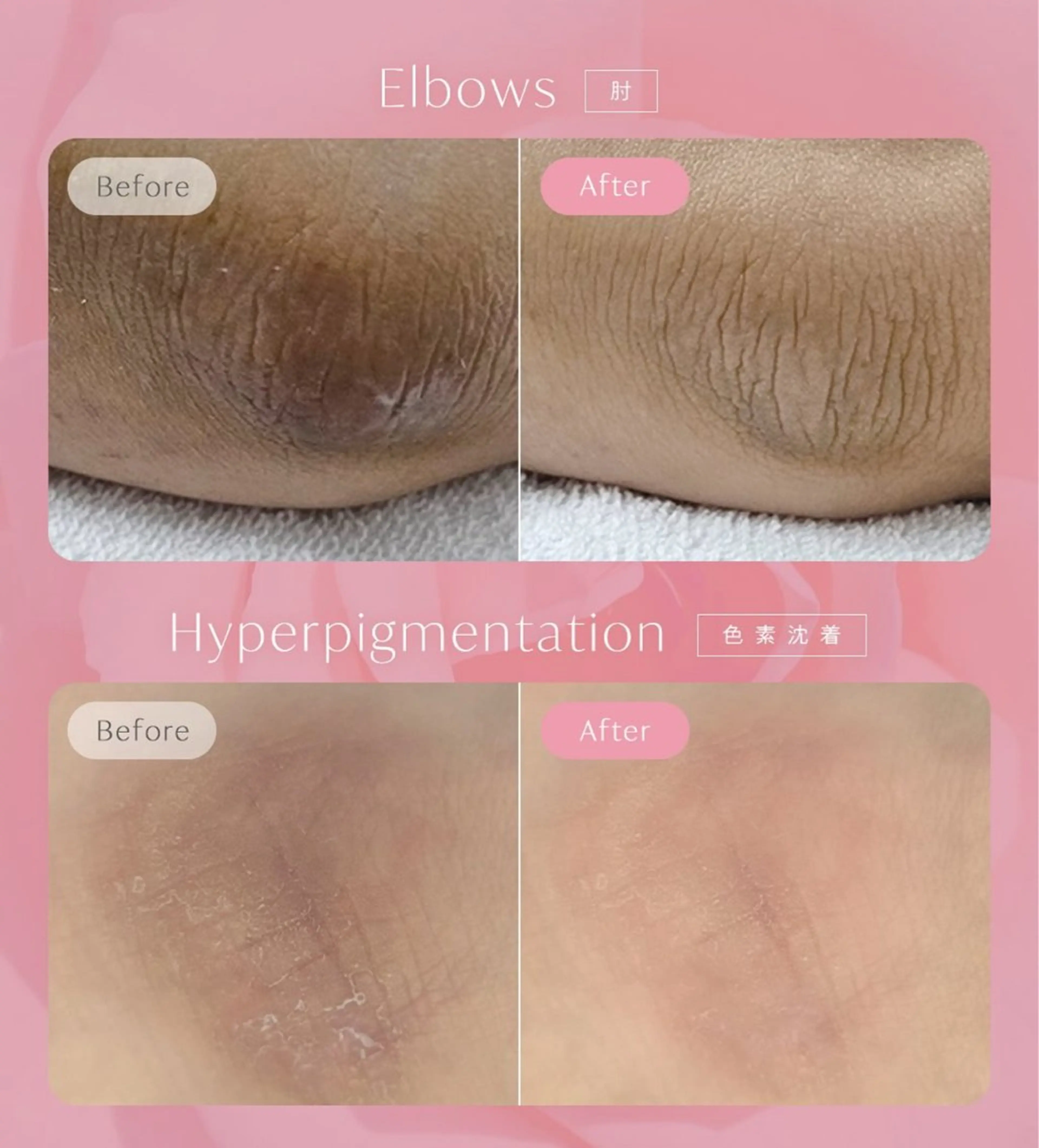 KIRAN 山﨑のエステ・リラクイメージ