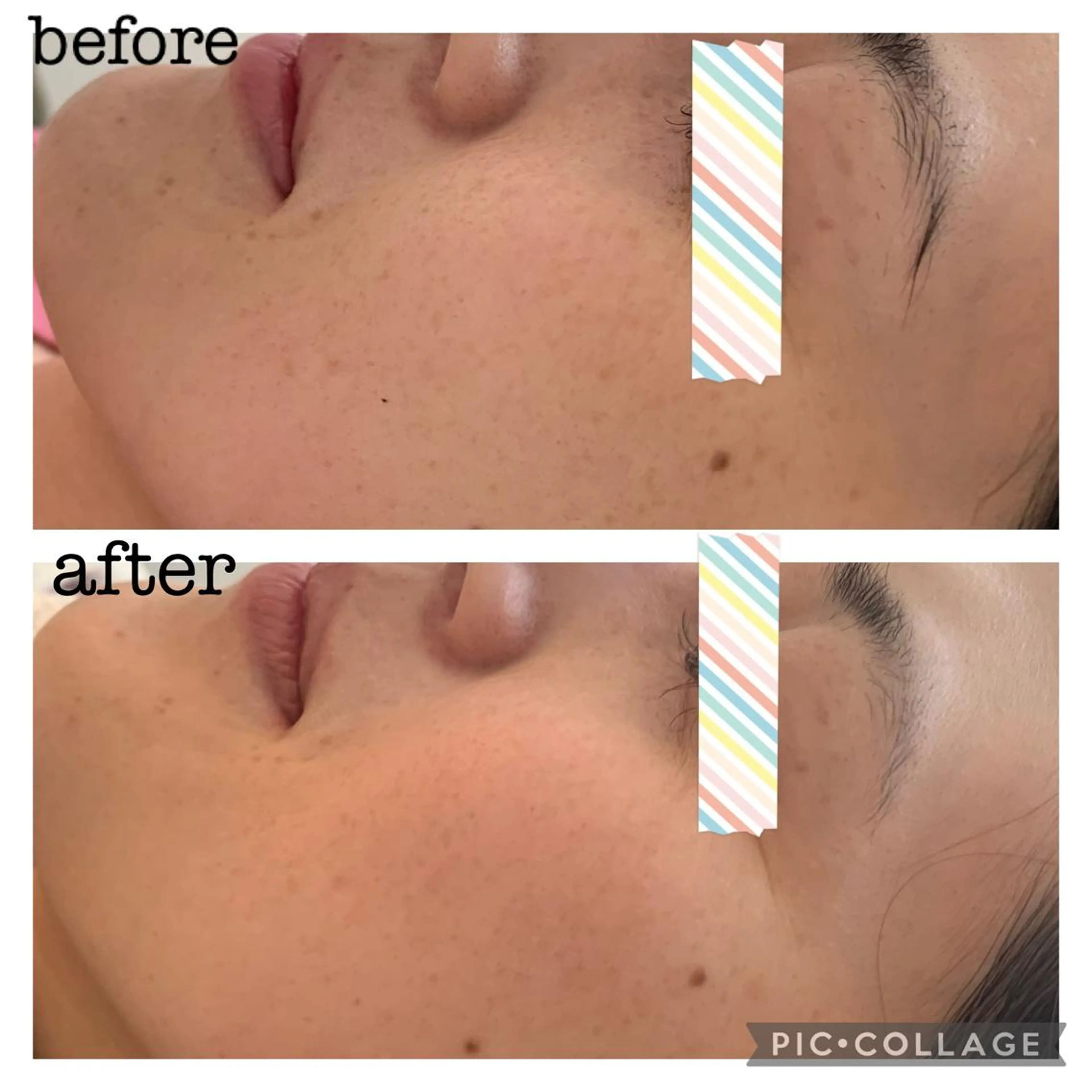 シミケア E Lashのエステ・リラクイメージ