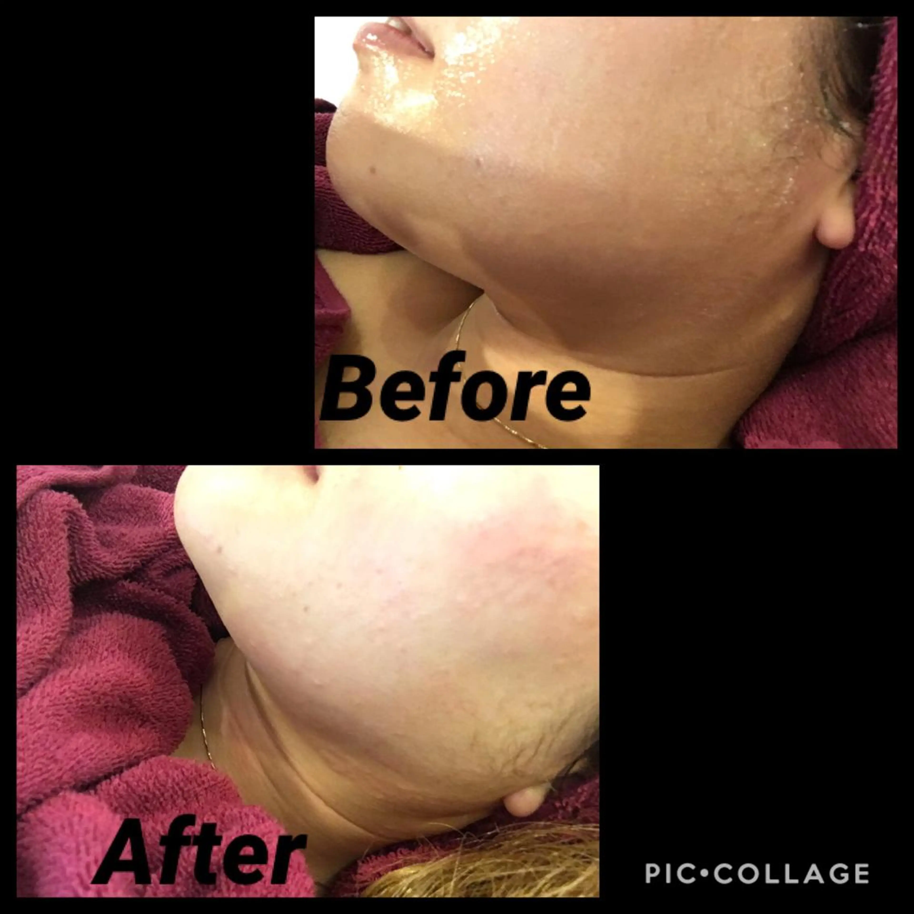 o3remedy所属・宇野澤 彩加のエステ・リラクイメージ