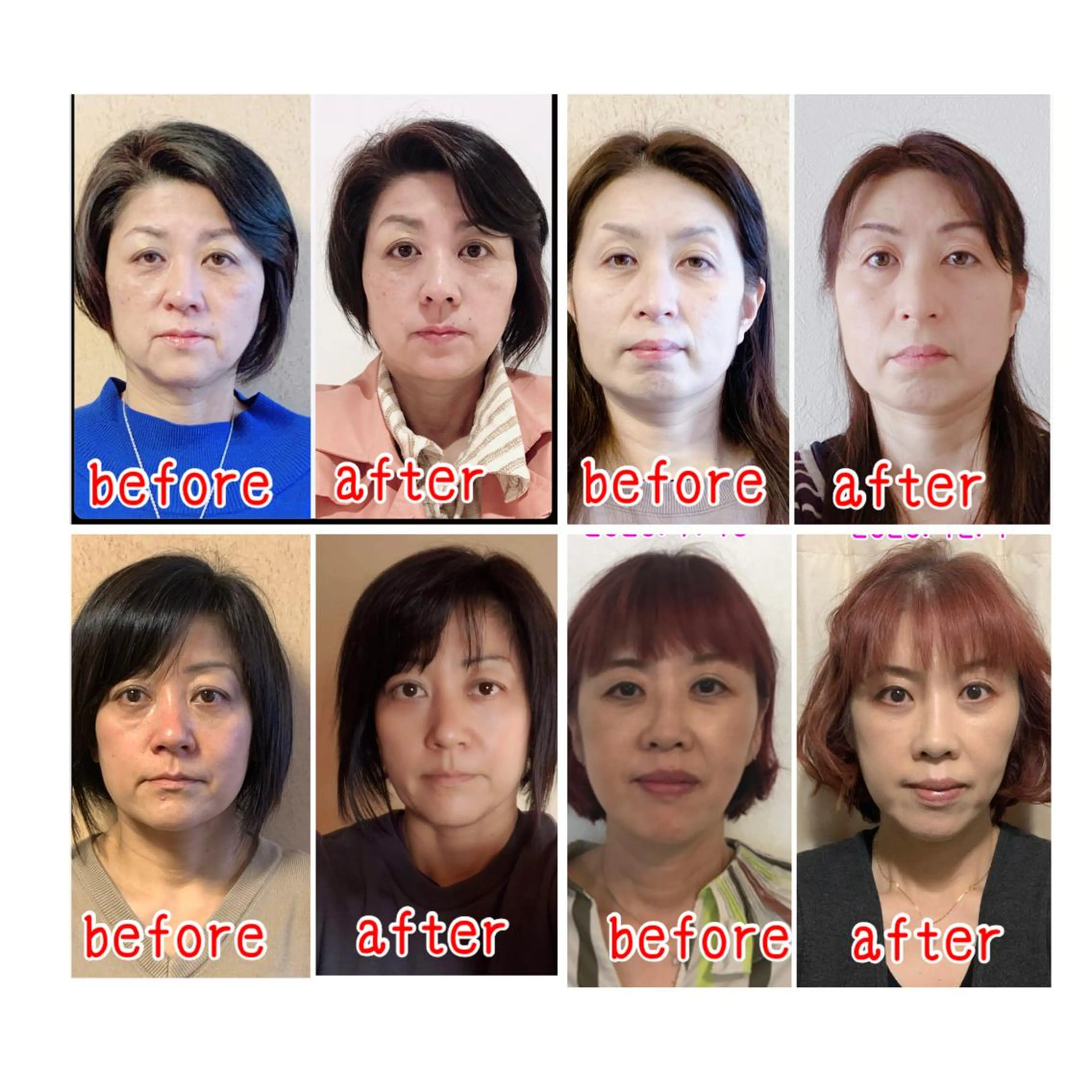 エステ 痛くない小顔矯正 小谷佳代子のエステ・リラクイメージ