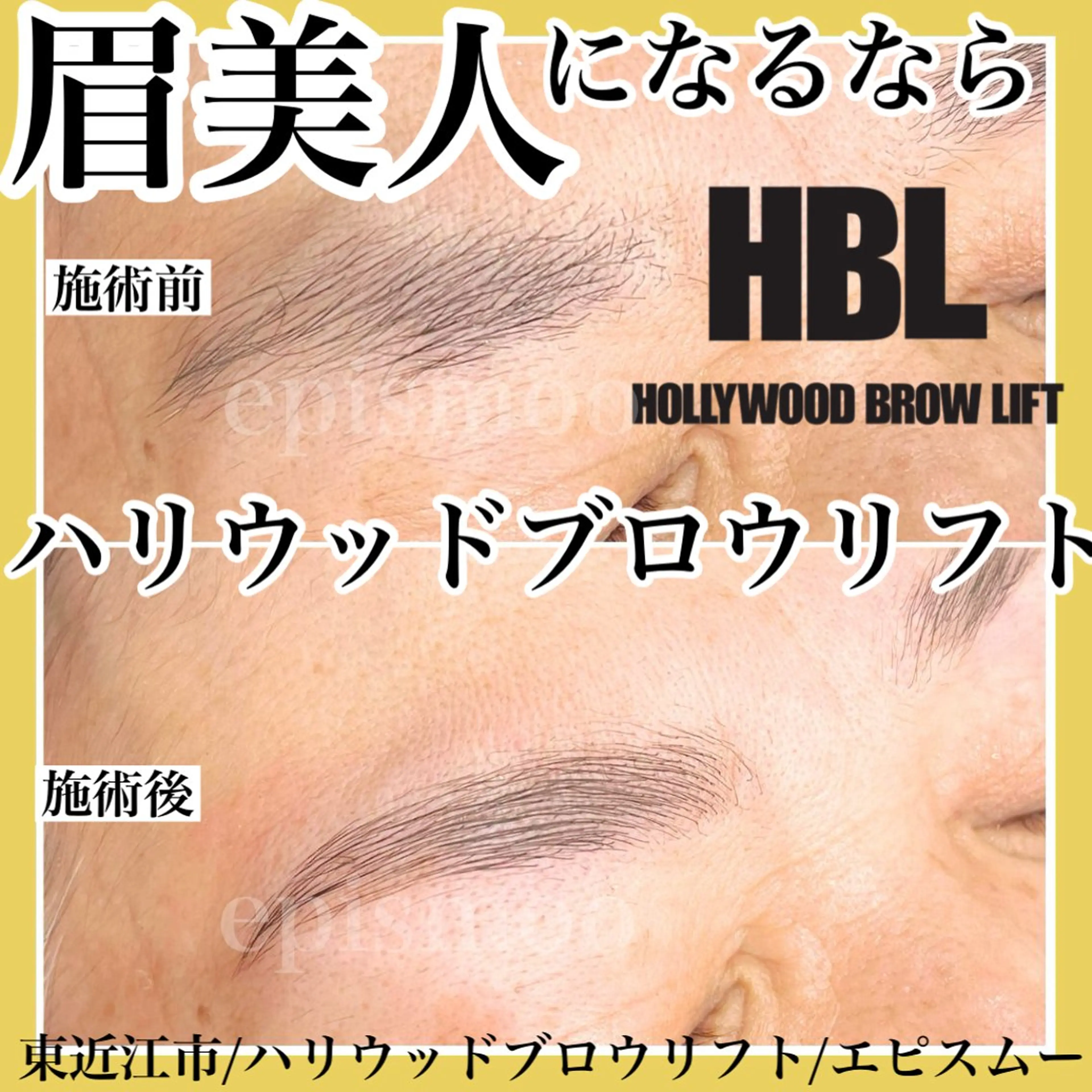 アイブロウ その他(アイブロウ) epismoo 脱毛/HBL/毛穴のエステ・リラクイメージ