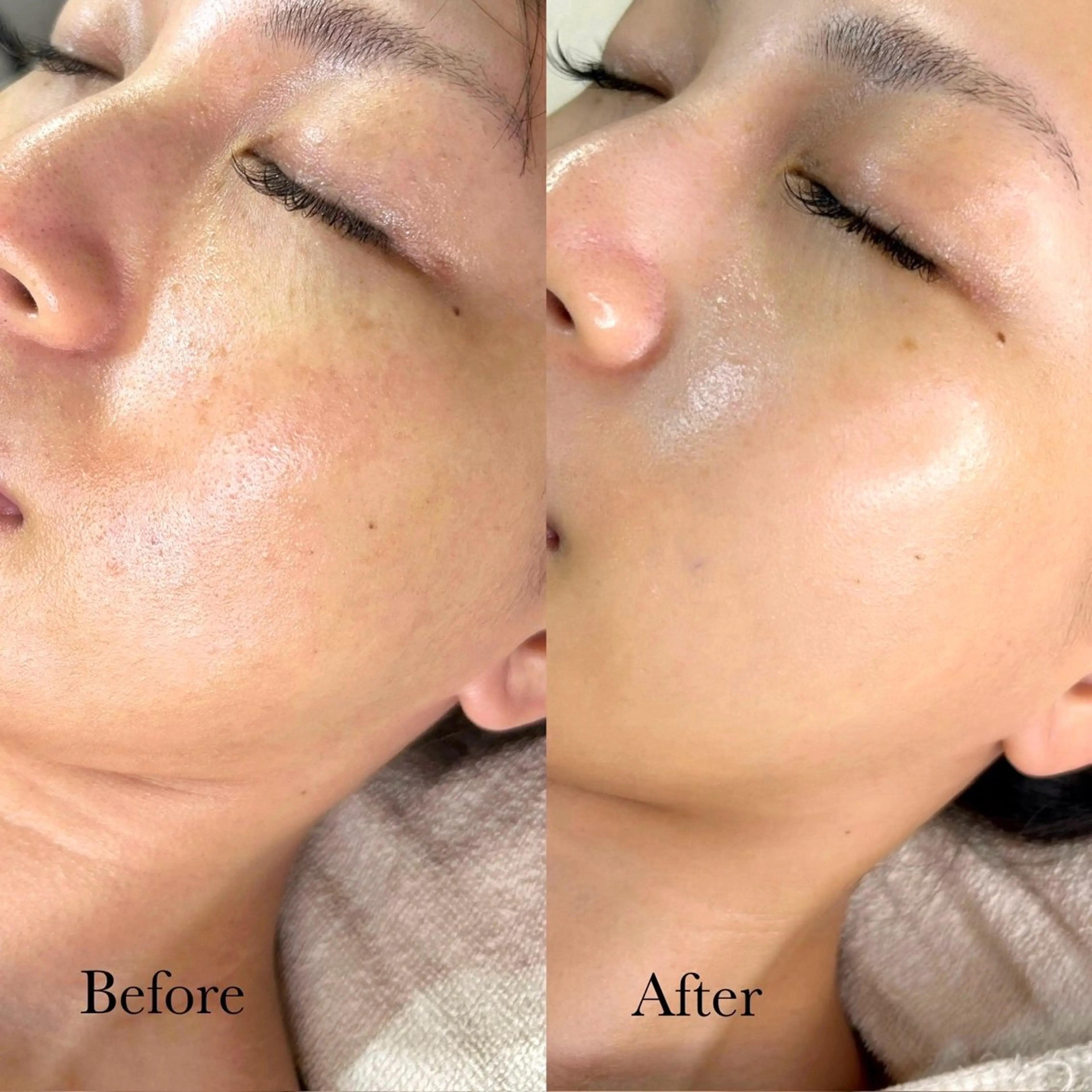 CHILO 銀座店のエステ・リラクイメージ