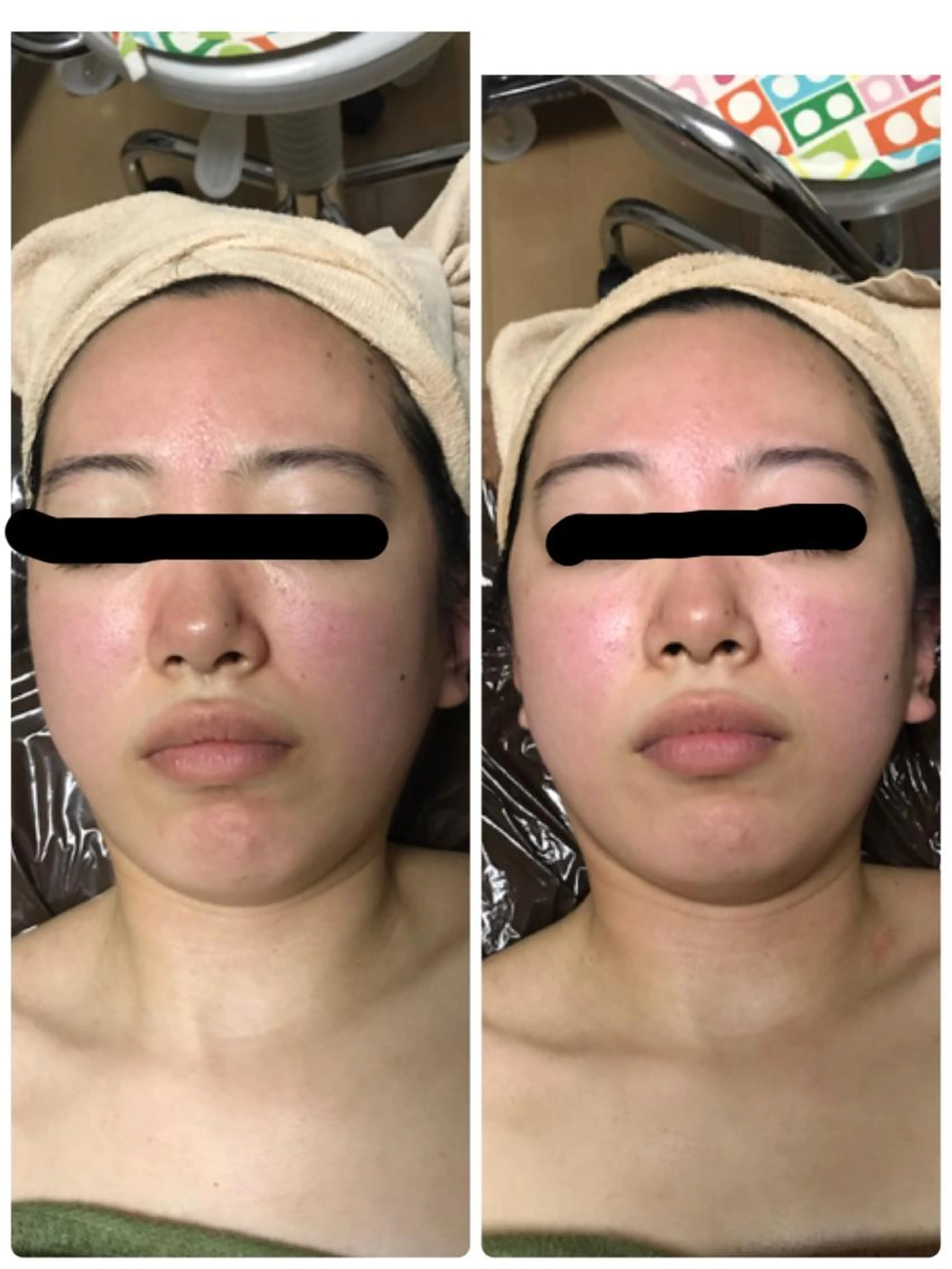 minimo限定✨口コミ&写真撮影クーポン✨写真の目は消します😌の写真