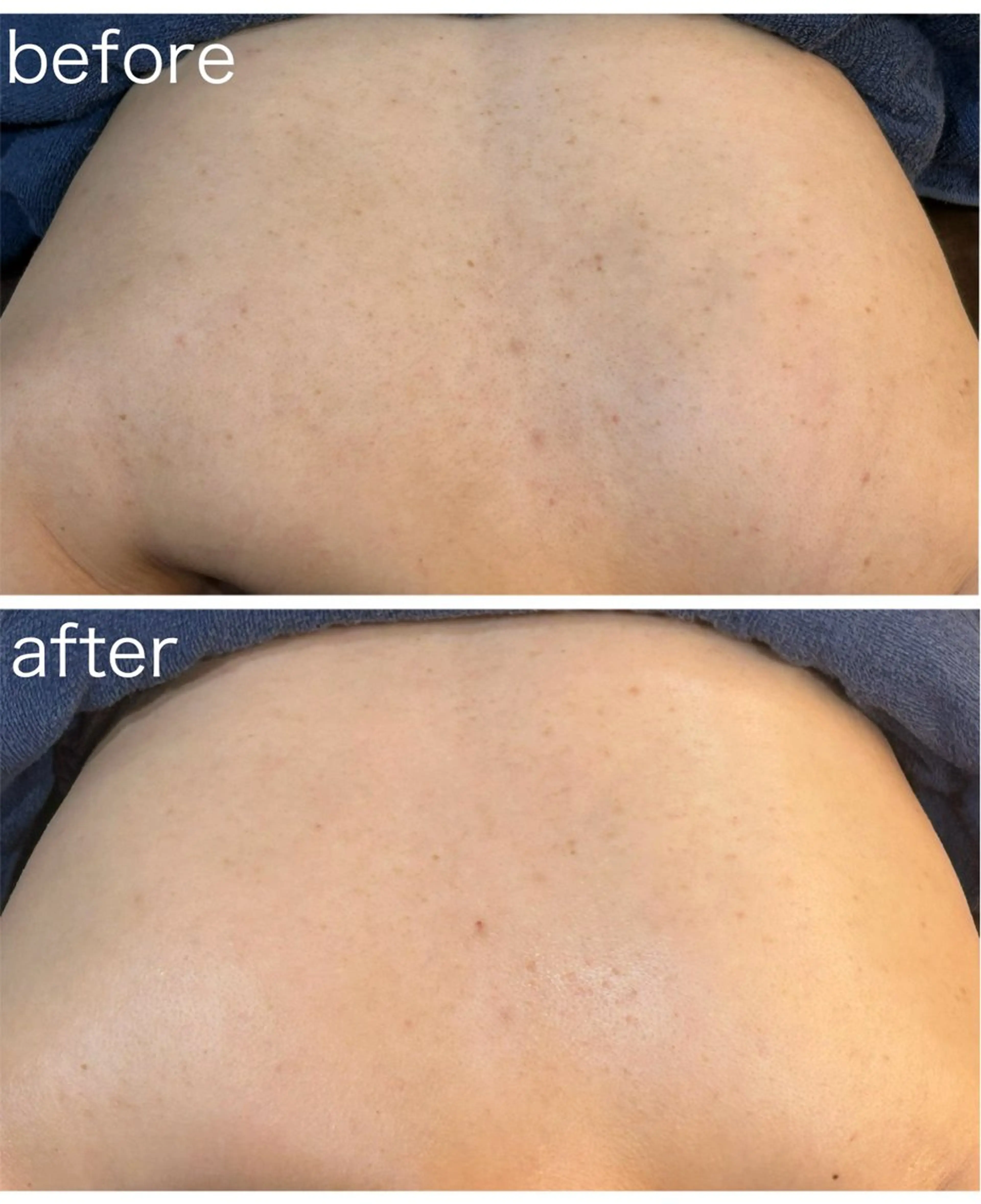 エステ leolo武蔵浦和 肌質改善＆脱毛のエステ・リラクイメージ