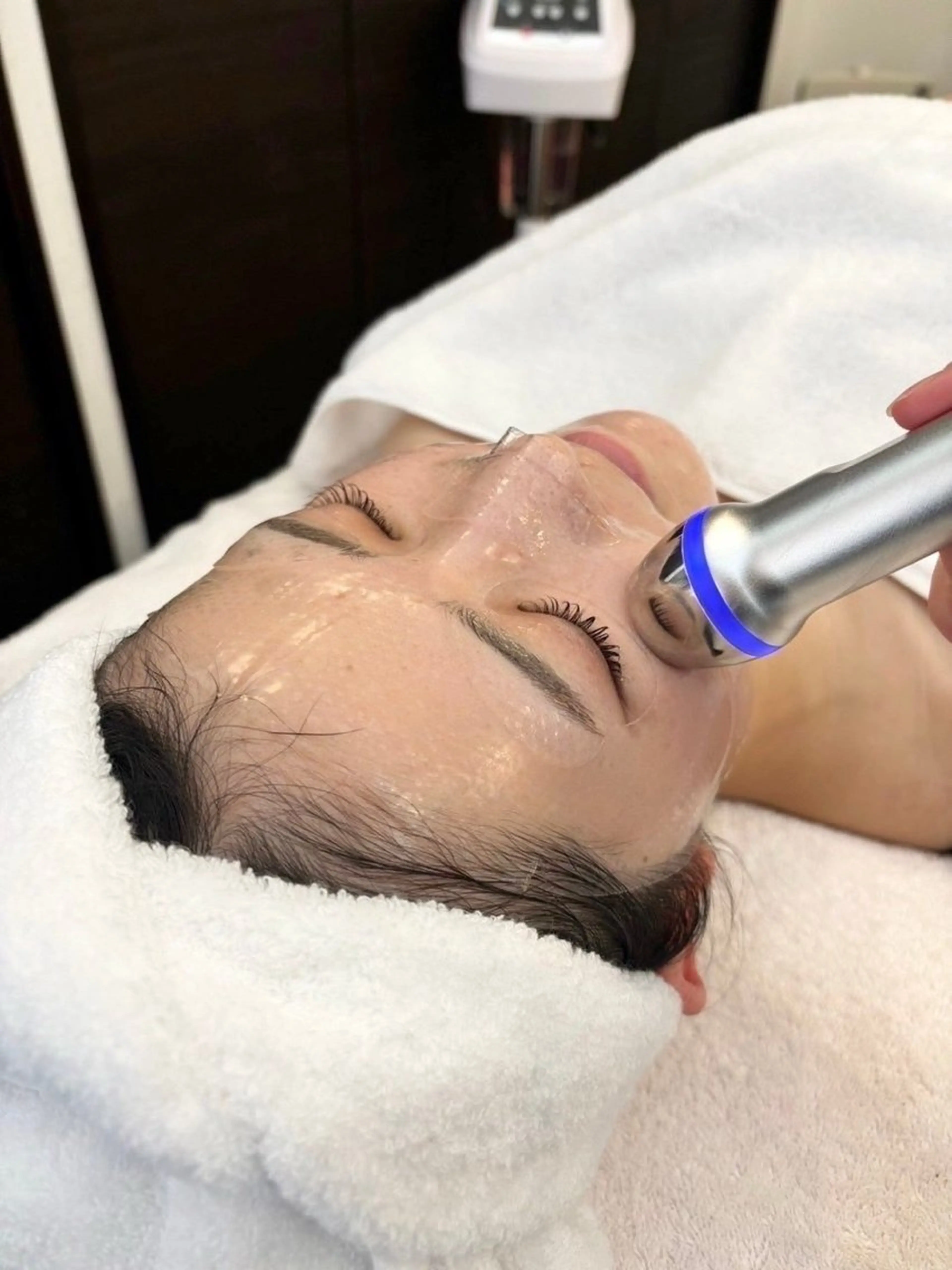 毛穴・ニキビまるごとケア◎毛穴洗浄×美肌マスク×LDMの写真