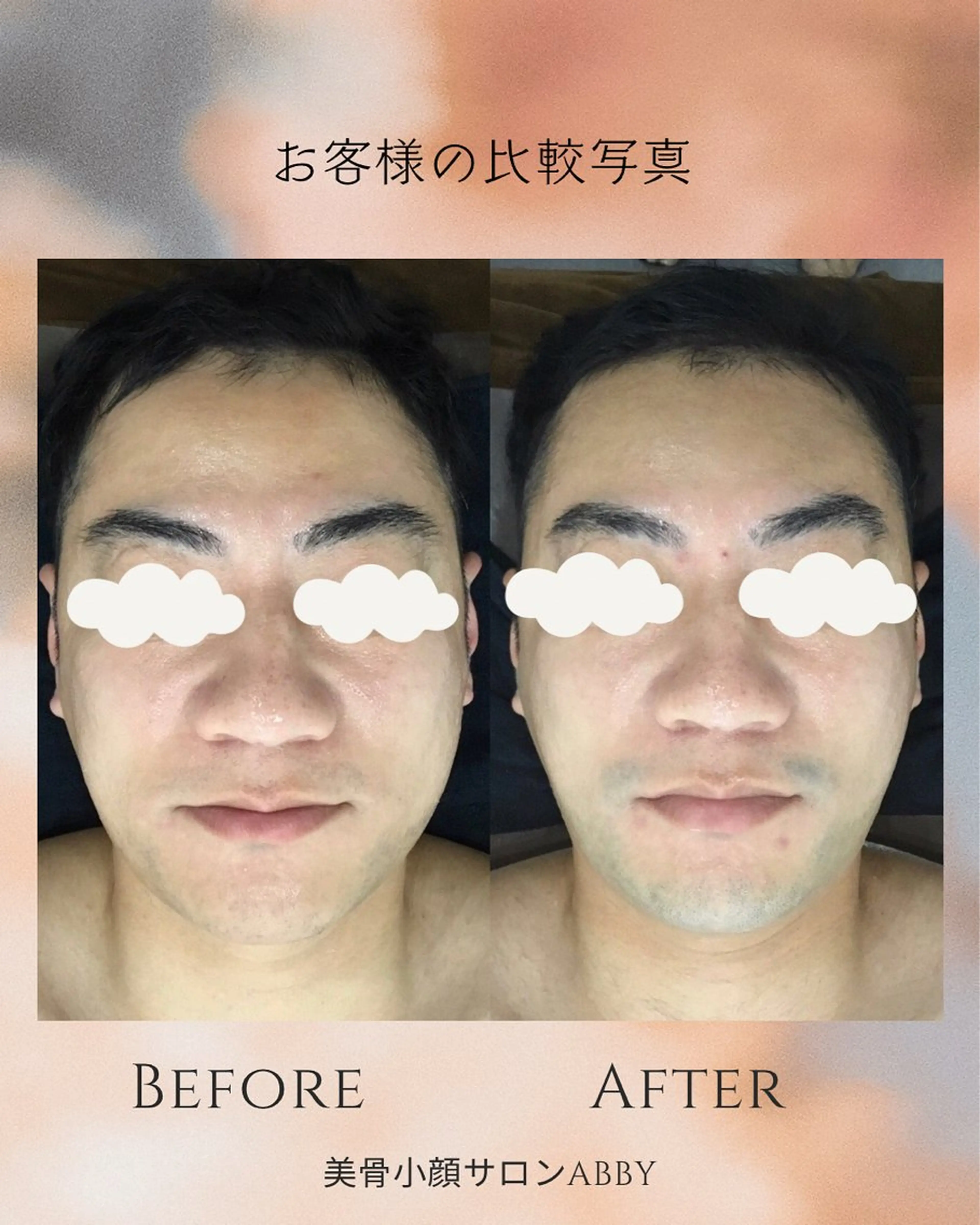 エステ リラク 小顔コルギ💎 ABBY SANOのエステ・リラクイメージ