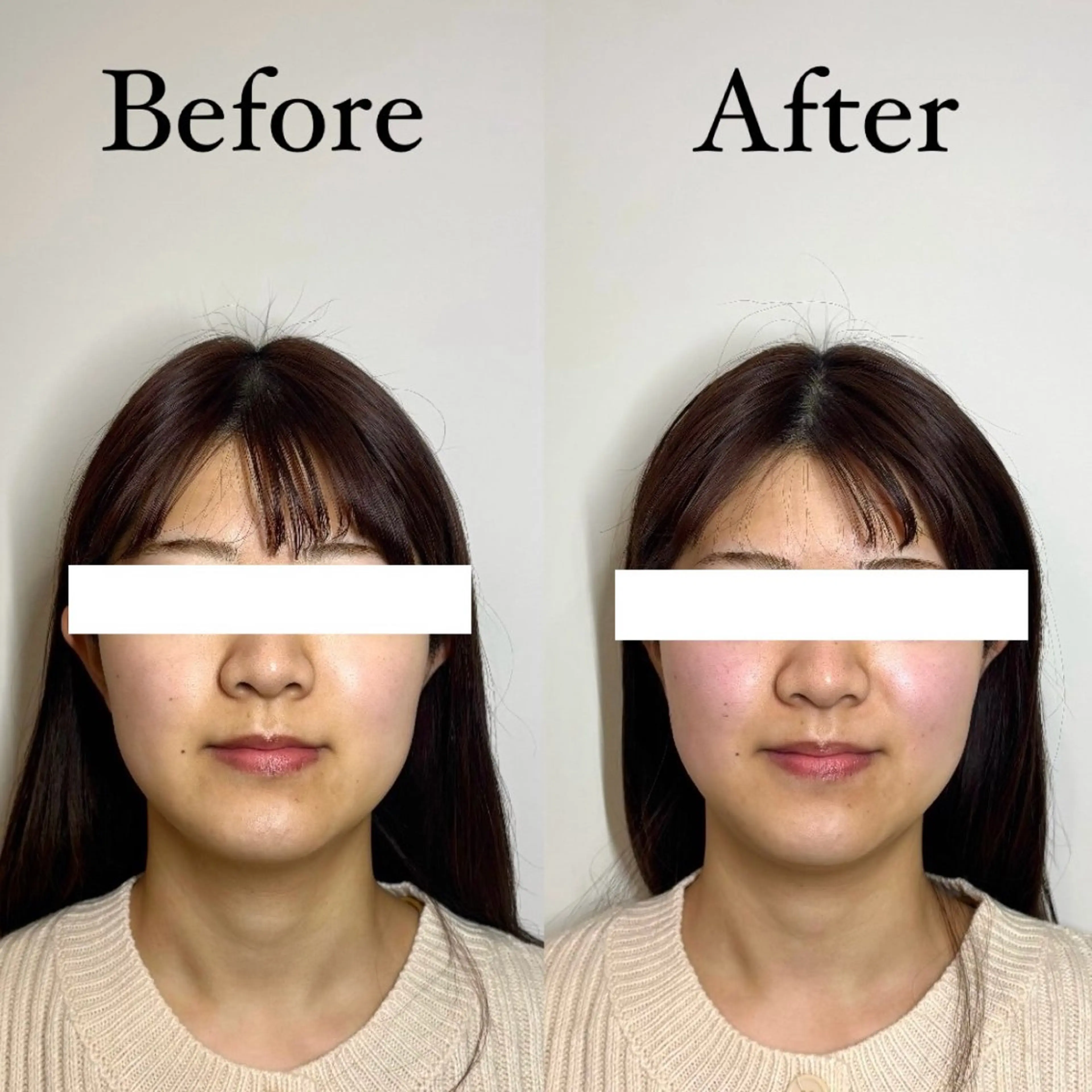 Hari Lounge恵比寿所属・chika🦋 ハリラウンジ恵比寿のエステ・リラクイメージ