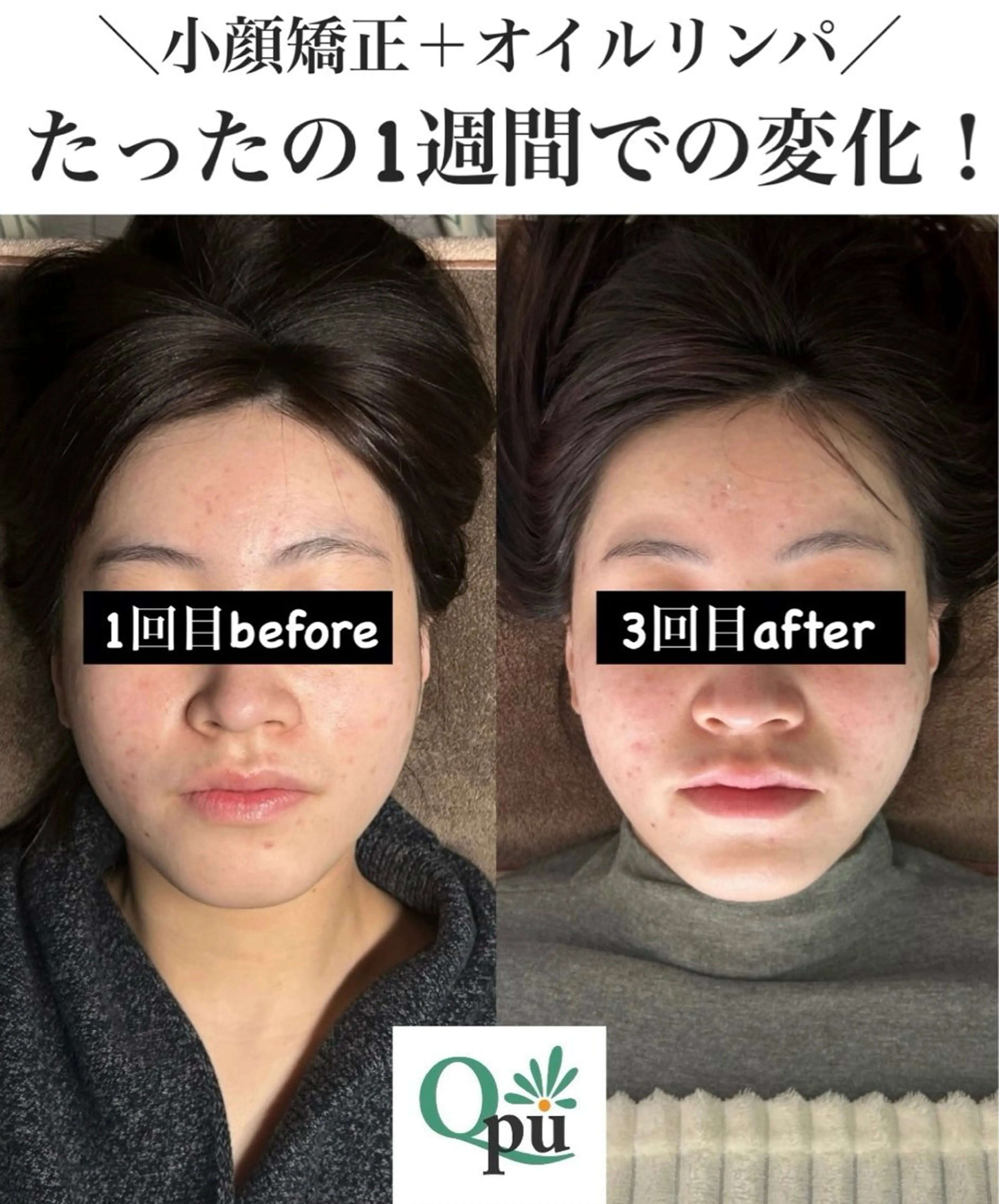 Qpu(キュープ)下北沢店所属・鮎川 さゆりのエステ・リラクイメージ